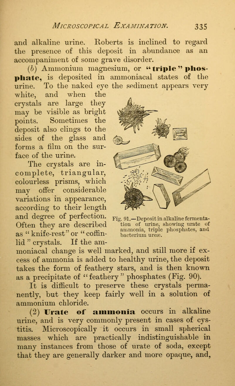 and alkaline urine. Roberts is inclined to regard the presence of this deposit in abundance as an accompaniment of some grave disorder. (6) Ammonium magnesium, or triple phos- phate, is deposited in ammoniacal states of the urine. To the naked eye the sediment appears very white, and when the crystals are large they may be visible as bright points. Sometimes the deposit also clings to the sides of the glass and forms a film on the sur- face of the urine. The crystals are in- complete, triangular, colourless prisms, which may offer considerable variations in appearance, according to their length and degree of perfection. Fig. 91.-Deposit in alkaline fermenta- Often they are described tlon of urine, showing urate of ,,^ .p ,5, ,, n^ auimonia, triple phosphates, and as  knife-rest or  COitin- bacterium ure^e. lid  crystals. If the am- moniacal change is well marked, and still more if ex- cess of ammonia is added to healthy urine, the deposit takes the form of feathery stars, and is then known as a precipitate of feathery phosphates (Fig. 90). It is difficult to preserve these crystals perma- nently, but they keep fairly well in a solution of ammonium chloride. (2) Urate of auiuiouia occurs in alkaline urine, and is very commonly present in cases of cys- titis. Microscopically it occurs in small spherical masses which are practically indistinguishable in many instances from those of urate of soda, except that they are generally darker and more opaque, and,