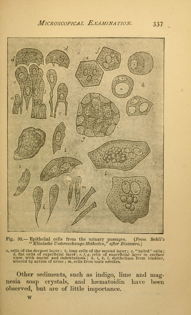 mmm§ mi ■)iiKil Fig. 93.— Epithelial cells from tlie uriuarj'- passages. (From Sahli's  Klinische Untersuchungs-Methoden, after Bizzozero.) a, cells of the deepest layer ; b, long cells of the second layer; c,  tailed cells ; d. flat cells of superficial layer; e, r'.sr, cells of superflcial layer in surface view, with nuclei and indentations ; h, i, k, I, epithelium from bladder, altered by action of urine ; m, cells from male urethra. Other sediments, such as indigo, lime and mag- nesia soap crystals, and haematoidin have been observed, but are of little importance. w