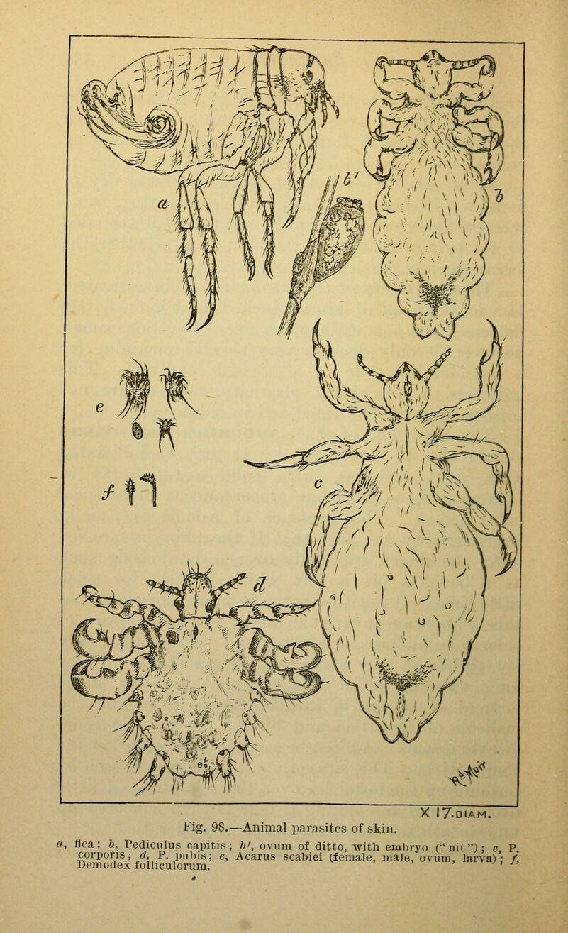 Fig. 98.—Animal parasites of skin. .^f^* X 17-OIAM. a, (lea; h, Pediculus capitis^; h', ovum of ditto, with eml)ryo (nit); c P corporis; f/, P. pubis; e, Acarus scabiei (female, male, ovum, larva); /! Demodex folliculorum.