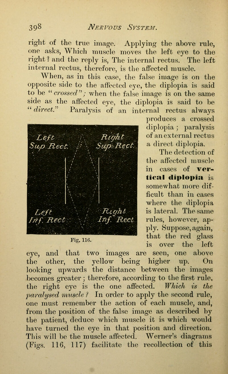 right of tho true image. Applying the above rule, one asks, Which muscle moves the left eye to the right] and the reply is, The internal rectus. The left internal rectus, therefore, is the affected muscle. When, as in this case, the false image is on the opposite side to the affected eye, the diplopia is said to be ^^ crossecV; when the false image is on the same side as the affected eye, the diplopia is said to be  direct.^'' Paralysis of an internal rectus always ]3roduces a crossed diplopia ; paralysis of an external rectus a direct diplopia. The detection of the affected muscle in cases of ver- tical diplopia is somewhat more dif- ficult than in cases where the diplopia is lateral. The same rules, however, ap- ply. Suppose, again, that the red glass is over the left eye, and that two images are seen, one above the other, the yellow being higher up. On looking upwards the distance between the images becomes greater; therefore, according to the first rule, the right eye is the one affected. Which is the paralysed muscle ? In order to apply the second rule, one must remember the action of each muscle, and, from the position of the false image as described by the patient, deduce which muscle it is which would have turned the eye in that position and direction. This will be the muscle affected, Werner's diagrams (Figs. 116, 117) facilitate the recollection of this