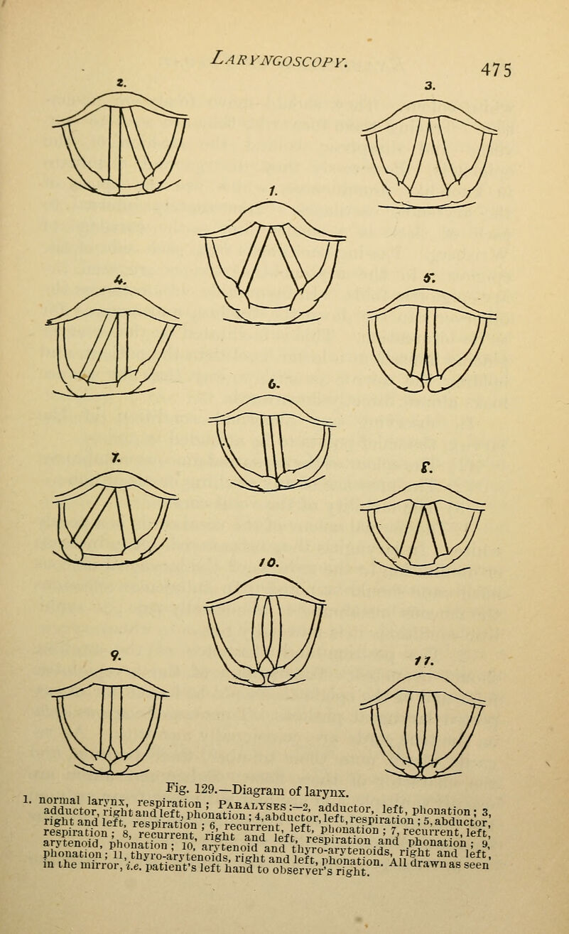 , , Fig, 129.—Diagram of larynx. right and left, respirat on ; 6 recuVrent ef^ nh^^^^^ = 5. abductor respiration : 8, recurrent rteht nVwi i^-fi ' P^i^iiation ; 7, recurrent, left, arytenoid, pWnS • ?o amenoM anfi t'hv^^^^^ phonation ; 9 Phonation ; 11, thyro-aVvteno?ds St ifr.Vi'iJT;?,'^''^^ P§^^t and left in the mirr'or/le.ytie'ii\-I'leffhao^o°?sifve\^\Tgh^ ^'^ ^'^'^''^^ ««^°
