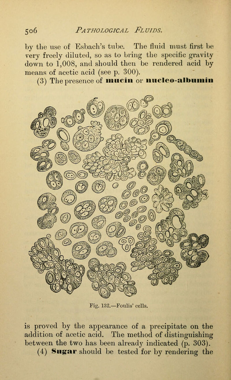 by tlie use of Esbach's tulje. The fluid must first be 7ery freely diluted, so as to bring the specific gravity down to 1,008, and should then be rendered acid by means of acetic acid (see p. 300). (3) The presence of imiciii or iiiicleo-albiiniin Fig, 132.—Foulis' cells. is proved by the appearance of a precipitate on the addition of acetic acid. The method of distinguishing betvi^een the two has been already' indicated (p. 303). (4) Siig-ar should be tested for by rendering the