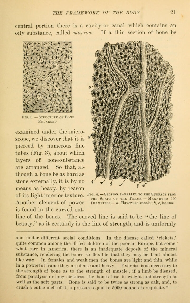 central portion there is a cavity or canal which contains an oily substance, called marrow. If a thin section of bone be Vv*  ->• i,-% Wm #& i v *« > Sfe Fie. 8.—Stro TIKE OF BoNI 1 i$m mm w - jm Fig. 4.— Section parallel to the Surface from the Shaft of the Femir. — Magnified 100 Diameters.— a, Haversian canals; b, c, lacuna1 examined under the micro- scope, we discover that it is pierced by numerous fine tubes (Fig. 3), about which layers of bone-substance are arranged. So that, al- though a bone be as hard as stone externally, it is by no means as heavy, by reason of its light interior texture. Another element of power is found in the curved out- line of the bones. The curved line is said to be the line of beauty, as it certainly is the line of strength, and is uniformly and under different social conditions In the disease called 'rickets,1 quite common among the ill-fed children of the poor in Europe, but some-' what rare in America, there is an inadequate deposit of the mineral substance, rendering the bones so flexible that they may be bent almost like wax. In females and weak nun the bones are light and thin, while in a powerful frame they are dense and heavy. Exercise is as necessary to the strength of bone as to the strength of muscle; if a limb be disused. from paralysis or long sickness, the bones lose in weight and strength as well as the soft parts. Bone is said to be twice as strong as oak. and. to crush a cubic inch of it, a pressure equal to 5000 pounds is requisite.