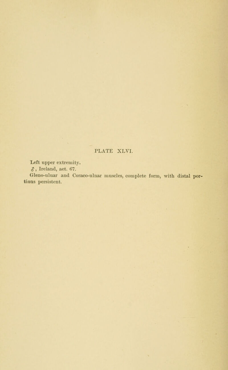 Left upper extremity. S, Ireland, aet. 67. Gleno-uluar and Coraco-uluar muscles, complete form, with distal por- tions persistent.