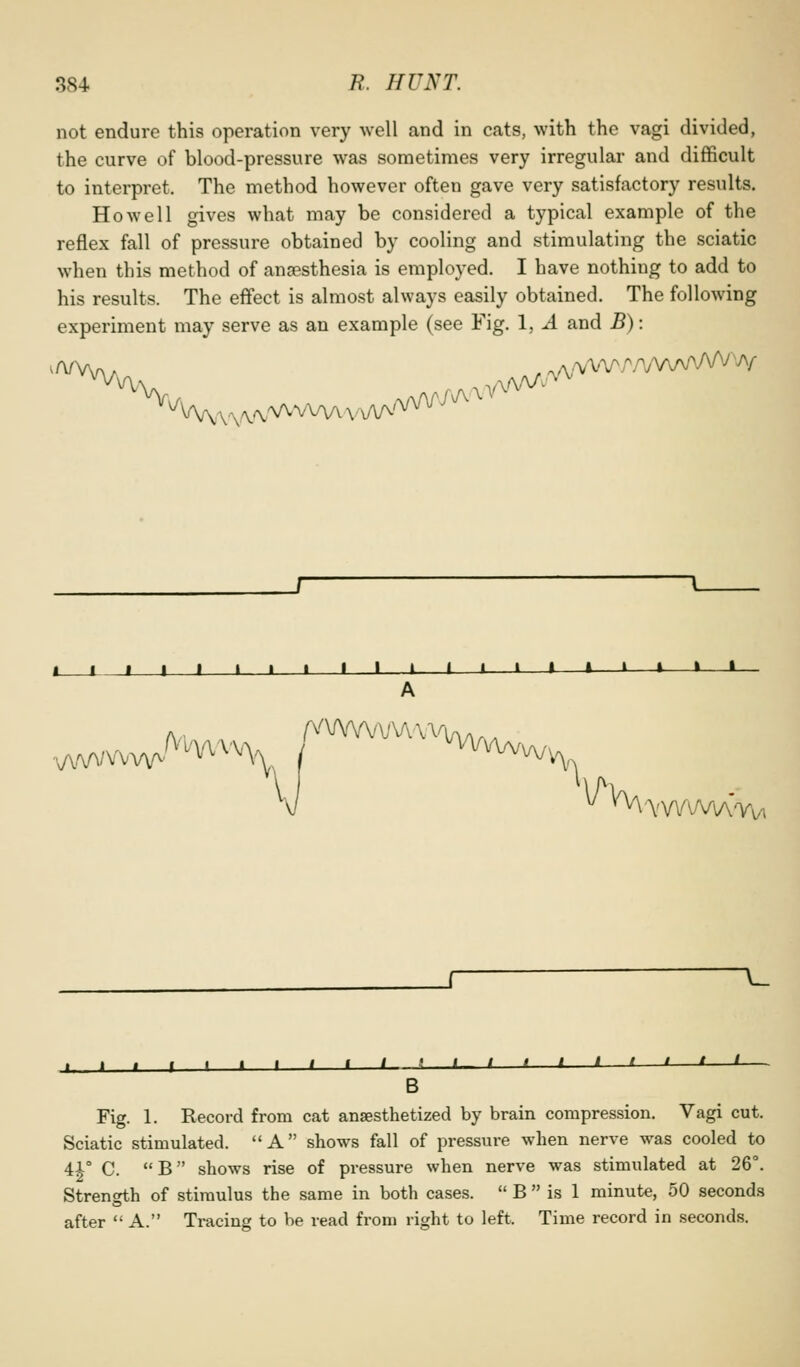 not endure this operation very well and in cats, with the vagi divided, the curve of blood-pressure was sometimes very irregular and difficult to interpret. The method however often gave very satisfactory results. Howell gives what may be considered a typical example of the reflex fall of pressure obtained by cooling and stimulating the sciatic when this method of anaesthesia is employed. I have nothing to add to his results. The effect is almost always easily obtained. The following experiment may serve as an example (see Fig. 1, A and B): I ■ I f I » I I I I I 1 1 i—I » » » » •— A _r —^ _£_- B Fig. 1. Record from cat anaesthetized by brain compression. Vagi cut. Sciatic stimulated. A shows fall of pressure when nerve was cooled to 4A° C. B shows rise of pressure when nerve was stimulated at 26°. Strength of stimulus the same in both cases.  B  is 1 minute, 50 seconds after  A. Tracing to be read from right to left. Time record in seconds.
