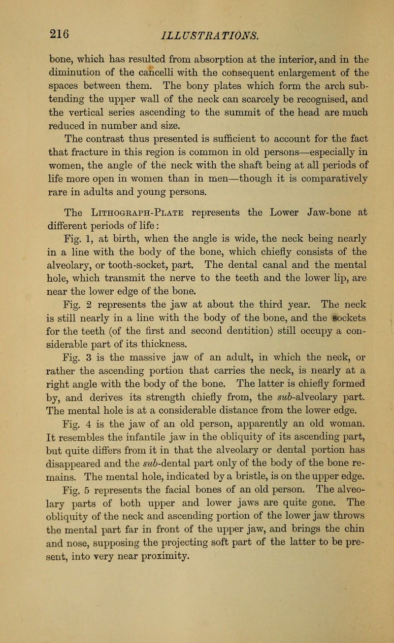 bone, which has resulted from absorption at the interior, and in the diminution of the cancelli with the consequent enlargement of the spaces between them. The bony plates which form the arch sub- tending the ujDper wall of the neck can scarcely be recognised, and the vertical series ascending to the summit of the head are much reduced in number and size. The contrast thus presented is sufficient to account for the fact that fracture in this region is common in old persons—especially in women, the angle of the neck with the shaft being at all periods of life more open in women than in men—though it is comparatively rare in adults and young persons. The Lithograph-Plate represents the Lower Jaw-bone at different periods of life: Fig. 1, at birth, when the angle is wide, the neck being nearly in a line with the body of the bone, which chiefly consists of the alveolary, or tooth-socket, part. The dental canal and the mental hole, which transmit the nerve to the teeth and the lower lip, are near the lower edge of the bone. Fig. 2 represents the jaw at about the third year. The neck is still nearly in a line with the body of the bone, and the sockets for the teeth (of the first and second dentition) still occupy a con- siderable part of its thickness. Fig. 3 is the massive jaw of an adult, in which the neck, or rather the ascending portion that carries the neck, is nearly at a right angle with the body of the bone. The latter is chiefly formed by, and derives its strength chiefly from, the s^*6-alveolary part. The mental hole is at a considerable distance from the lower edge. Fig. 4 is the jaw of an old person, apparently an old woman. It resembles the infantile jaw in the obliquity of its ascending part, but quite differs from it in that the alveolary or dental portion has disappeared and the sw6-dental part only of the body of the bone re- mains. The mental hole, indicated by a bristle, is on the upper edge. Fig. 5 rex:)resents the facial bones of an old person. The alveo- lary parts of both upper and lower jaws are quite gone. The obliquity of the neck and ascending portion of the lower jaw throws the mental part far in front of the upper jaw, and brings the chin and nose, supposing the projecting soft part of the latter to be pre- sent, into very near proximity.