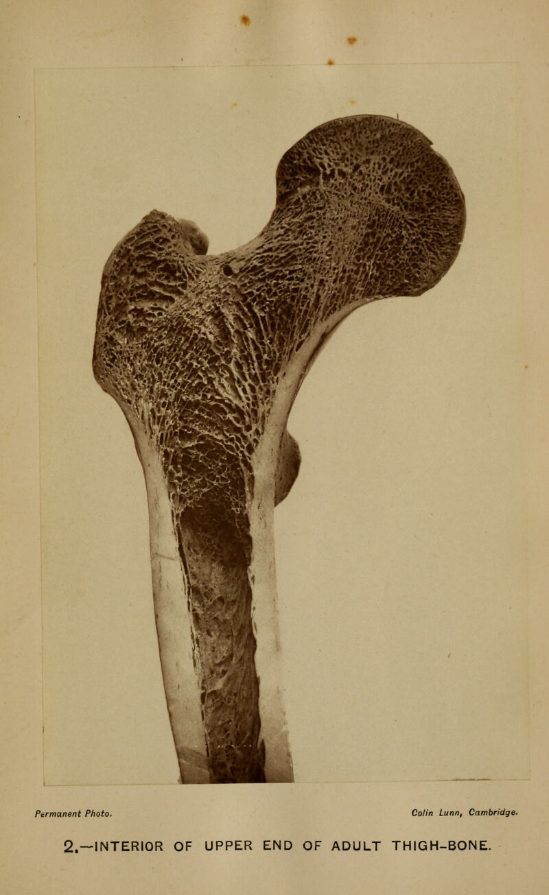 Permanent Photo. Colin Lunn, Cambridge. 2.—INTERIOR OF UPPER END OF ADULT THIGH-BONE.