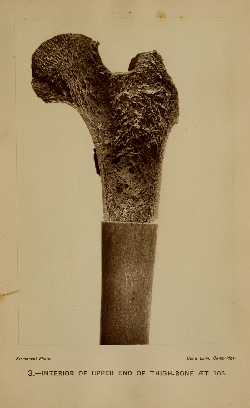 Permanent Photo. Colin Lunn, Cambridge. 3.—INTERIOR OF UPPER END OF THIGH-BONE /ET 103.