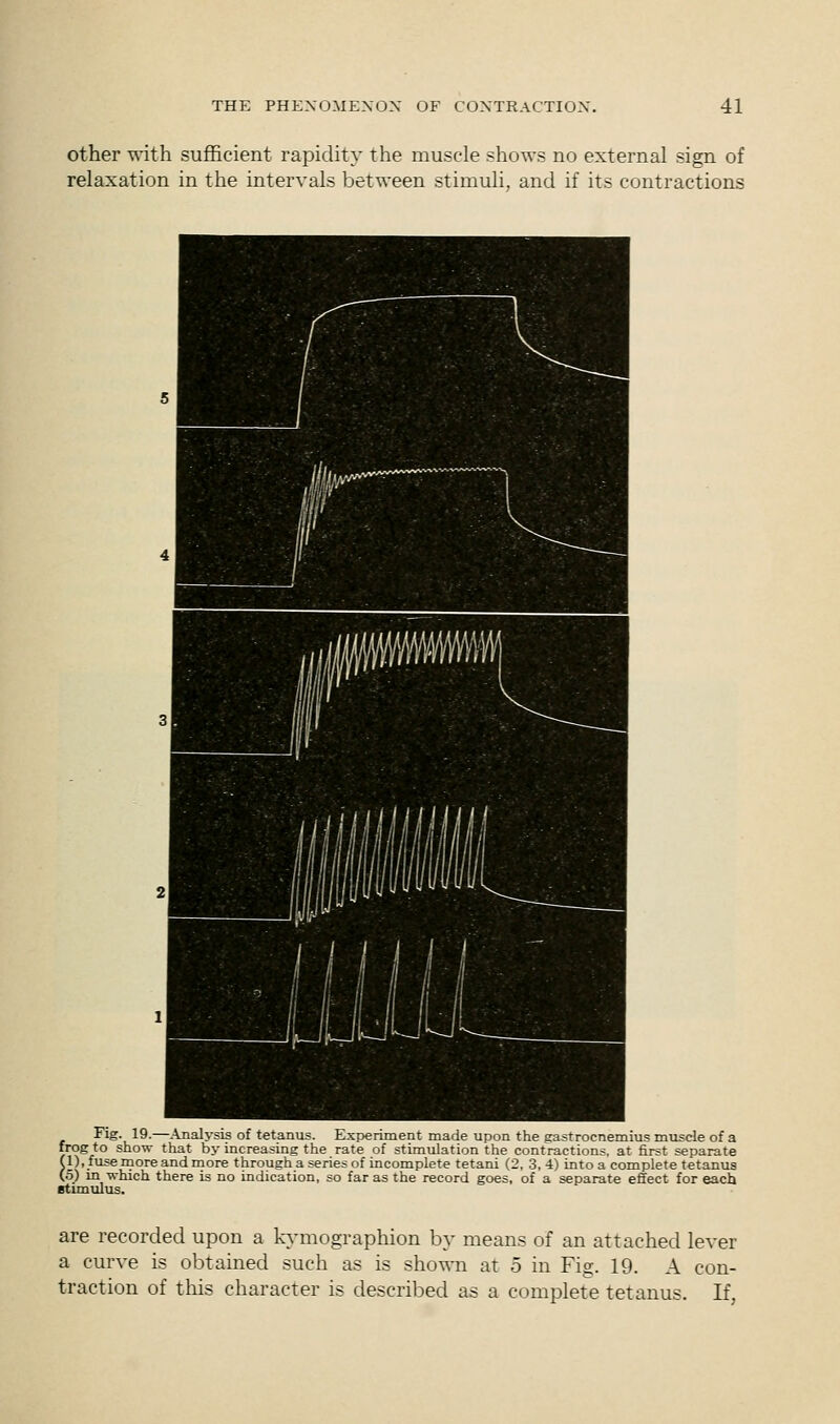 other with sufficient rapidity the muscle shows no external sign of relaxation in the intervals between stimuli, and if its contractions Fig. 19.—Analysis of tetanus. Experiment made upon the gastrocnemius muscle of a frog to show that by increasing the rate of stimulation the contractions, at first separate (1), fuse more and more through a series of incomplete tetani (2, 3, 4) into a complete tetanus (5) in which there is no indication, so far as the record goes, of a separate effect for each stimulus. are recorded upon a kymographion by means of an attached lever a curve is obtained such as is shown at 5 in Fig. 19. A con- traction of this character is described as a complete tetanus. If,