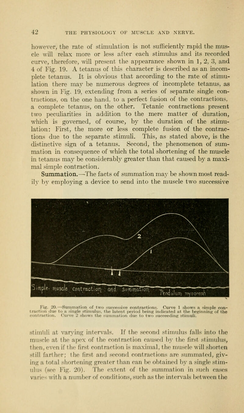 however, the rate of stimulation is not sufficiently rapid the mus- cle will relax more or less after each stimulus and its recorded curve, therefore, will present the appearance shown in 1, 2, 3, and 4 of Fig. 19. A tetanus of this character is described as an incom- plete tetanus. It is obvious that according to the rate of stimu- lation there may be numerous degrees of incomplete tetanus, as shown in Fig. 19, extending from a series of separate single con- tractions, on the one hand, to a perfect fusion of the contractions, a complete tetanus, on the other. Tetanic contractions present two peculiarities in addition to the mere matter of duration, which is governed, of course, by the duration of the stimu- lation: First, the more or less complete fusion of the contrac- tions due to the separate stimuli. This, as stated above, is the distinctive sign of a tetanus. Second, the phenomenon of sum- mation in consequence of which the total shortening of the muscle in tetanus may be considerably greater than that caused by a maxi- mal simple contraction. Summation. —The facts of summation may be shown most read- ily by employing a device to send into the muscle two successive jifOple- iTiuscie contraction_ and Sii*niT\aiior{ Fiic. 20.—Summation of two successive contractions. Curve 1 shows a simple con- i raction ;lw<- to ■■> single stimulu . the latent period being indicated at the beginning of the contraction. Curve - show- th ti in due to two succeeding stimuli. stimuli at varying intervals. If the second stimulus falls into the muscle at the apex of the contraction caused by the first stimulus, then, even if t he firs! conl racl ion is maximal, I tie muscle will shorten si ill farther; the firsl and second contractions are summated, giv- ing .-i total shortening greater than can be obtained by a single stim- ulus (see Fig. 20). The extenl of the summation in such cases varie ■'. 1' h b n umbel- of conditions, such as the intervals bel ween the