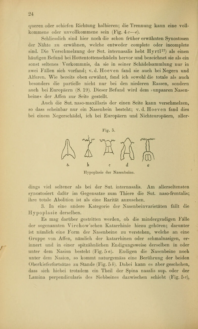 queren oder schiefen Richtung halbieren; die Trennung kann eine voll- kommene oder unvollkommene sein (Fig. 4 c—e). Schliesslich sind hier noch die schon früher erwähnten Synostosen der Nähte zu erwähnen, welche entweder complete oder incoraplete sind. Die Verschmelzung der Sut. interuasalis hebt Hyrtl-^) als einen häufigen Befund bei Hottentottenschädeln hervor und bezeichnet sie als ein sonst seltenes Vorkommnis, da sie in seiner Schädelsammlung nur in zwei Fällen sich vorfand; v. d. Hoeven fand sie auch bei Negern und Alfuren. Wie bereits oben erwähnt, fand ich sowohl die totale als auch besonders die partielle nicht nur bei den niederen Rassen, sondern auch bei Europäern (S. 19). Dieser Befund wird dem »unpaaren Nasen- beine« der Affen zur Seite gestellt. Auch die Sut. naso-maxillaris der einen Seite kann verschmelzen, so dass scheinbar nur ein Nasenbein besteht; v. d. Hoeven fand dies bei einem Negerschädel, ich bei Europäern und Nichteuropäern, aller- ^ b c d e Hypoplasie der Nasenbeine. dings viel seltener als bei der Sut. interuasalis. Am allerseltensten synostosiert dafür im Gegensatze zum Thiere die Sut. naso-frontalis; ihre totale Abolition ist als eine Rarität anzusehen. 3. In eine andere Kategorie der Nasenbeinvarietäten fällt die Hypoplasie derselben. Es mag darüber gestritten Averden, ob die mindergradigen Fälle der sogenannten Virchow'schen Katarrhinie hiezu gehören; darunter ist nämlich eine Form der Nasenbeine zu verstehen, welche an eine Gruppe von Affen, nämlich der katarrhinen oder schmalnasigen, er- innert und in einer spitzäiinliehen Endigungsweise derselben in oder unter dem Nasion besteht (Fig. 5 a). Endigen die Nasenbeine noch unter dem Nasion, so kommt naturgeraäss eine Berührung der beiden Oberkieferfortsätze zu Stande (Fig. 5 b). Dabei kann es aber geschehen, dass sich hicbei trotzdem ein Theil der Spina nasalis sup. oder der Lamina perpondicularis des Siebbeines dazwischen schiebt (Fig. 5 c),