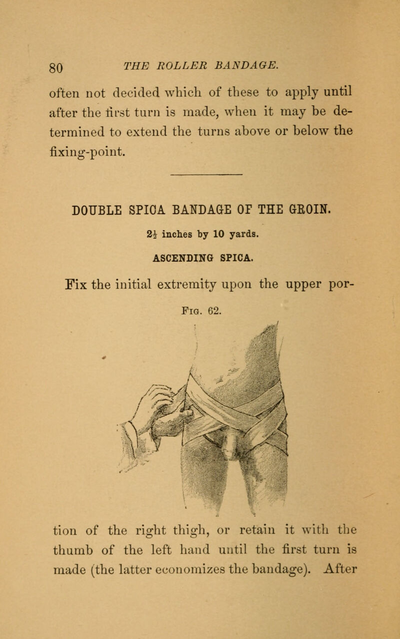 often not decided which of these to apply until after the tirst turn is made, when it may be de- termined to extend the turns above or below the fixing-point. DOUBLE SPIOA BATOAaE OF THE GROIN. 2i inches by 10 yards. ASCENDING SPICA. Fix the initial extremity upon the upper por- FiG. 62. J^ tion of the right thigh, or retain it with the thumb of the left hand until the first turn is made (the latter economizes the bandage). After