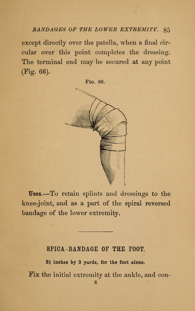 except directly over the patella, when a final cir- cular over this point completes the dressing. The terminal end may be secured at any point (Fig. 66). Fig. 66. Uses.—To retain splints and dressings to the knee-joint, and as a part of the spiral reversed bandage of the lower extremity. SPIOA-BANDAGE OF THE TOOT. 2^ inches by 3 yards, for the foot alone. Fix the initial extremity at the ankle, and con- 8