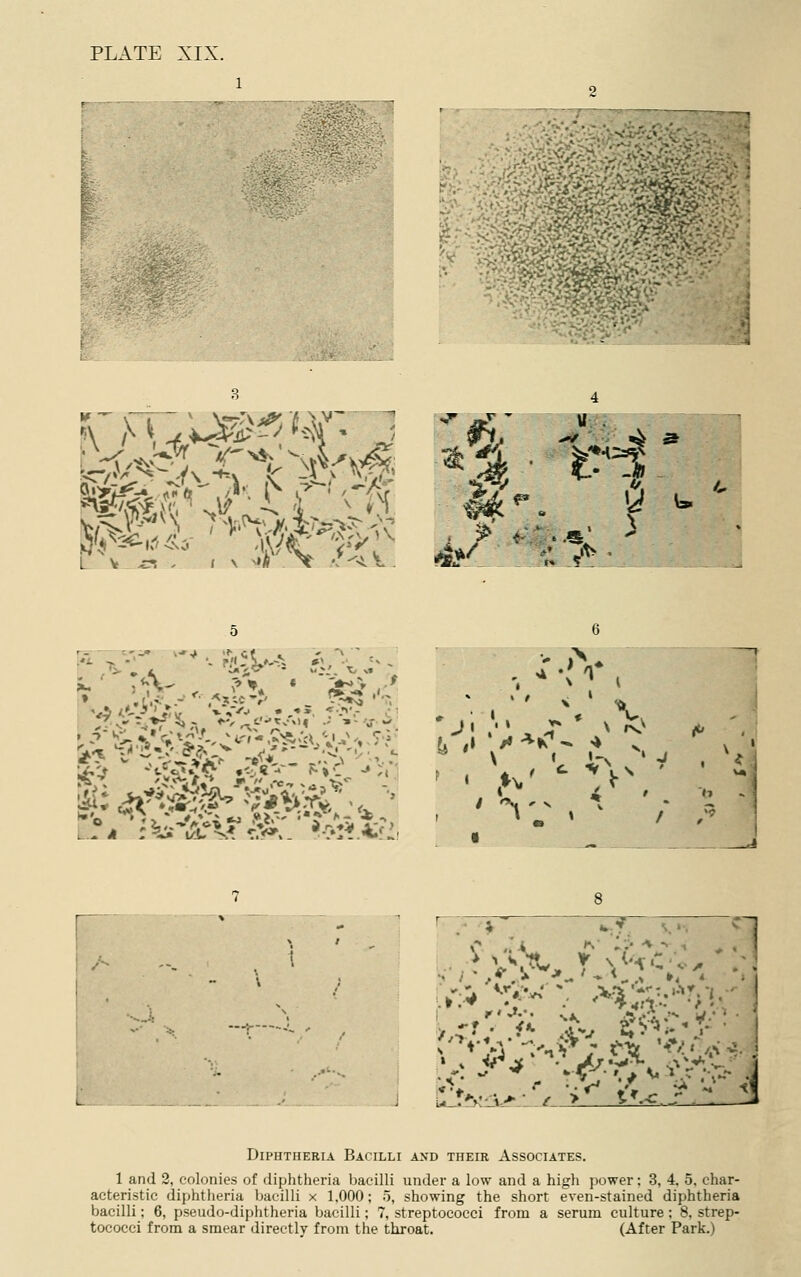 PLATE XIX. 2 . , ■ ■ • ' ■' '' '.-,.'■>■'•i'/'iV. - • > *;r,' 1. ** ■ ^ • '• c* ' 5? • ■^i,f^^^v f>i':-^'/.-'\-^':' ■ ^■^ :'<{ty 5r<j. ■'■X',: . ll'- f. '.^Vv  i'f.^' ' i-' i ■.■■ -'J ' i/VT £_■_ _-L.^:J.i: •:.:.-:f.:)tmmA ^^^. 4 t^^ 4^.!^ Diphtheria Bacilli and their Associates. 1 and 2, colonies of diphtheria bacilli under a low and a high power; 3, 4, 5, char- acteristic diphtheria bacilli x 1,000; 5, showing the short even-stained diphtheria bacilli; 6, pseudo-diphtheria bacilli; 7, streptococci from a serum culture; 8, strep- tococci from a smear directly from the throat. (After Park.)