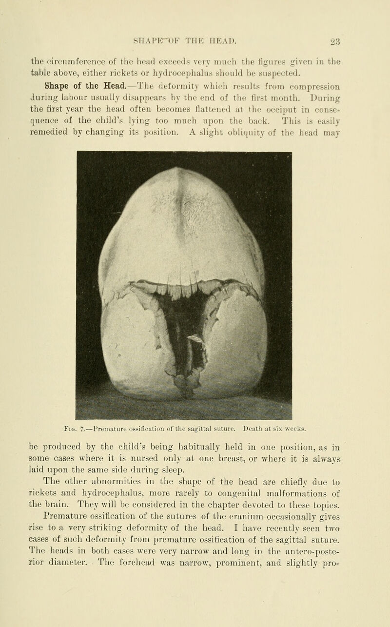 the circumference of the head exceeds very much the figures given in the table above, either rickets or hydrocephakis should be suspected. Shape of the Head.—The deformity which results from compression during labour usually disappears by the end of the first month. During the first year the head often becomes flattened at the occiput in conse- quence of the child's lying too much upon the back. This is easily remedied by changing its position. A slight obliquity of the head may Fig. 7.—Premature ossification of the sagittal suture. Death at six weeks. be produced by the child's being habitually held in one position, as in. some cases where it is nursed only at one breast, or where it is always laid upon the same side during sleep. The other abnormities in the shape of the head are chiefly due to rickets and hydrocephalus, more rarely to congenital malformations of the brain. They will be considered in the chapter devoted to these tojDics. Premature ossification of the sutures of the cranium occasionally gives rise to a very striking deformity of the head. I have recently seen two cases of such deformity from premature ossification of the sagittal suture. The heads in both cases were very narrow and long in the antero-poste- rior diameter. The forehead was narrow, prominent, and slightly pro-