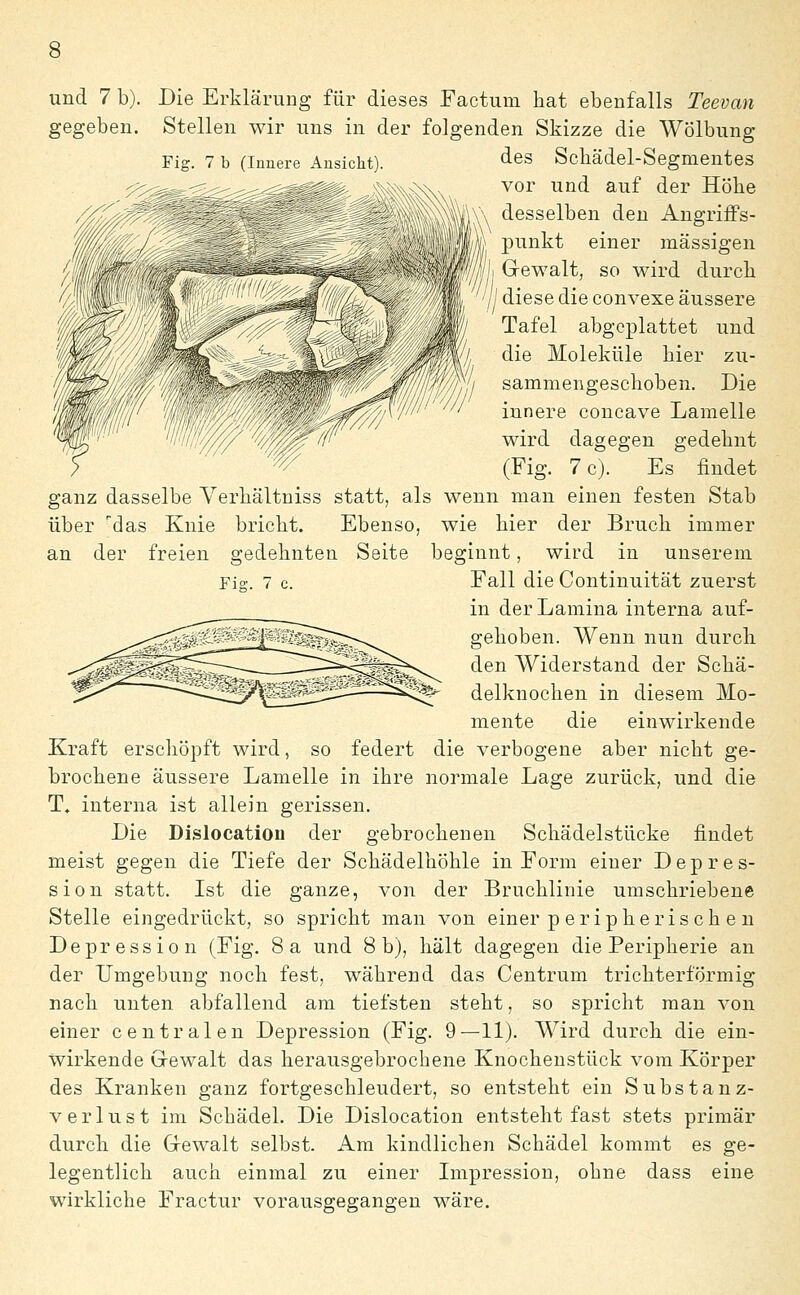 gegeben. Stellen wir uns in der folgenden Skizze die Wölbung Fig. 7 b (Innere Ansicht). des Scbädel-Segmentes vor und auf der Höhe desselben den Angriffs- punkt einer massigen Gewalt, so wird durch /) diese die convexe äussere Tafel abgeplattet und die Moleküle hier zu- sammengeschoben. Die innere concave Lamelle wird dagegen gedehnt (Fig. 7 c). Es findet ganz dasselbe Verhältniss statt, als wenn man einen festen Stab über das Knie bricht. Ebenso, wie hier der Bruch immer an der freien gedehnten Seite beginnt, wird in unserem Fig. 7 c. Fall die Continuität zuerst in derLamina interna auf- gehoben. Wenn nun durch den Widerstand der Schä- delknochen in diesem Mo- mente die einwirkende Kraft erschöpft wird, so federt die verbogene aber nicht ge- brochene äussere Lamelle in ihre normale Lage zurück, und die T. interna ist allein gerissen. Die Dislocatiou der gebrochenen Schädelstücke findet meist gegen die Tiefe der Schädelhöhle in Form einer Depres- sion statt. Ist die ganze, von der Bruchlinie umschriebene Stelle eingedrückt, so spricht man von einer p eripheris ch e n Depression (Fig. 8a und 8b), hält dagegen die Peripherie an der Umgebung noch fest, während das Centrum trichterförmig nach unten abfallend am tiefsten steht, so spricht man von einer centralen Depression (Fig. 9—11). Wird durch die ein- wirkende Grewalt das herausgebrochene Knochenstück vom Körper des Kranken ganz fortgeschleudert, so entsteht ein Substanz- verlust im Schädel. Die Dislocatiou entsteht fast stets primär durch die Grewalt selbst. Am kindlichen Schädel kommt es ge- legentlich auch einmal zu einer Lnpression, ohne dass eine wirkliche Fractur vorausgegangen wäre.