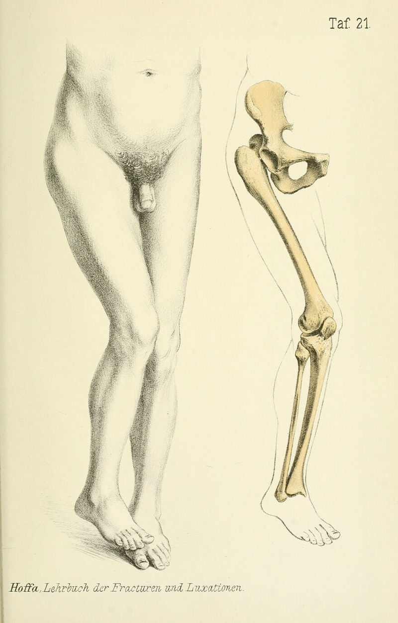 \ \ lIoifoi,LeliTbiicli derFi-dctweii iinöi LiixaUonen.