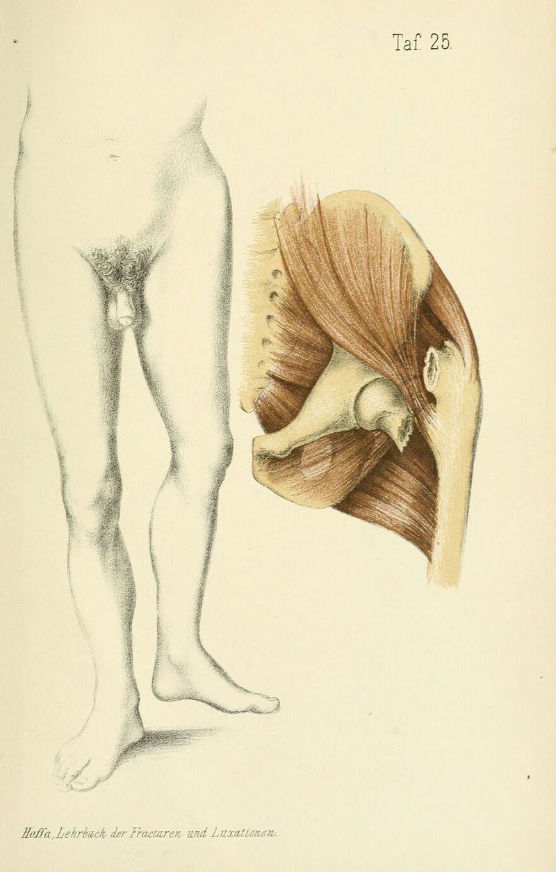 M Hoffa.LehrhucIv der Fractaren Rnd LuxcLtioneri/.