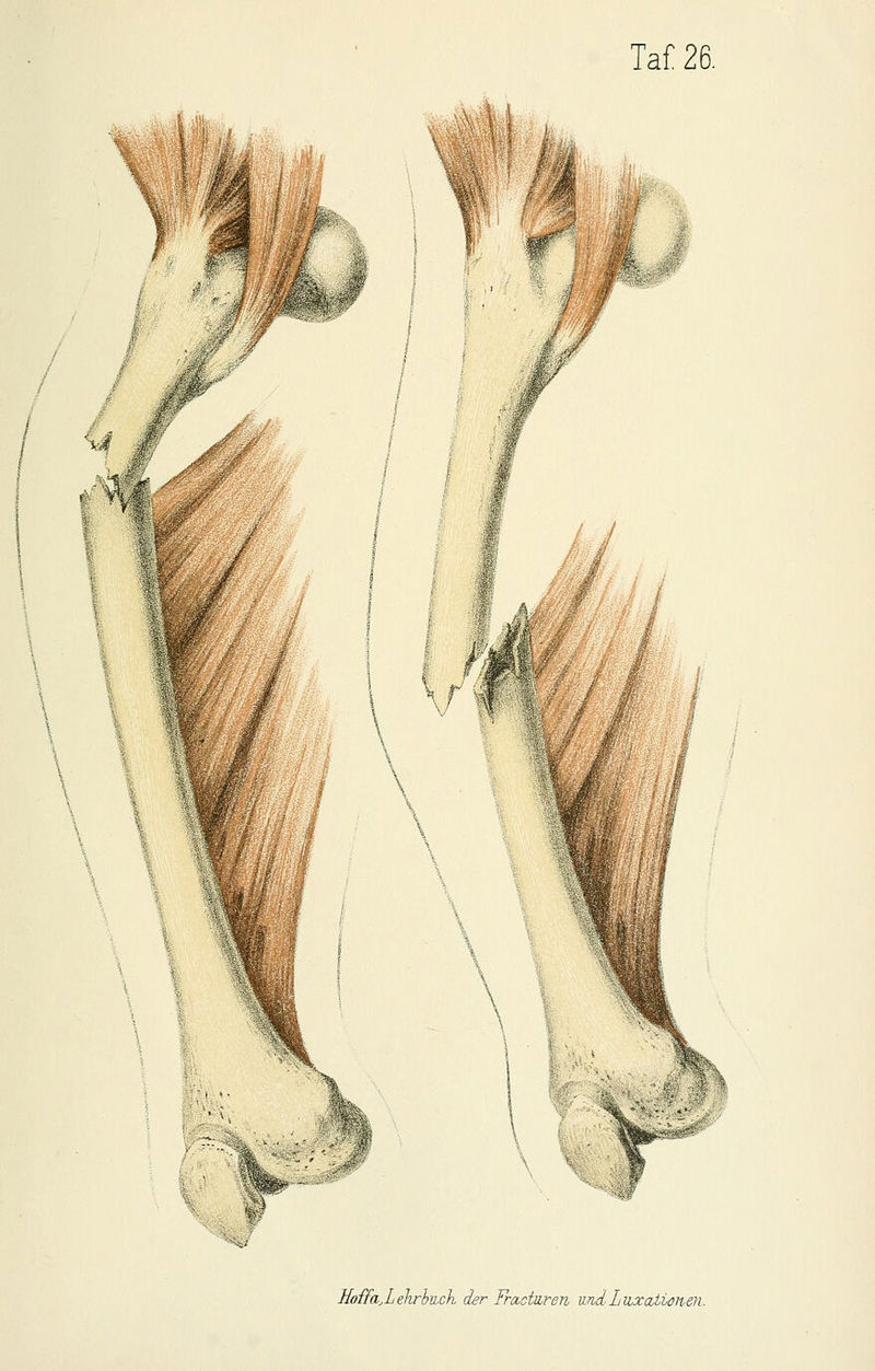 \k»-41 Moffa.Lehrbuch der Fractiiren und,Liixalionen.