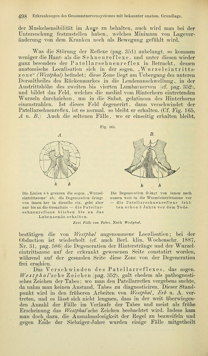 der Muskelsensibilität im Au^e zu behalten, aucb wird man bei der Untersuchung festzustellen haben, welches Minimum von Lagever- änderung von dem Kranken noch als Bewegung gefühlt wird. Was die Störung der Reflexe (pag. 351) anbelangt, so kommen weniger die Haut- als die Sehnenreflexe. und unter diesen wieder ganz besonders der Patellarsehnenreflex in Betracht, dessen anatomische Localisation sich in der sogen. „AVurzeleintritts- z one (Westphal) befindet; diese Zone liegt am Uebergang des unteren Dorsaltheiles des Rückenmarkes in die Lendenanschwellung, in der Austrittshöhe des zweiten bis vierten Lumbarnerven (cf. pag. 352), und bildet das Feld, welches die medial vom Hinterhorn eintretenden Wurzeln durchziehen, um in die Subst. gelatinosa des Hinterhorns einzustrahlen. Ist dieses Feld degenerirt, dann verschwindet der Patellarsehnenreflex, ist es normal, so bleibt er erhalten. (Cf. Fig. 165, A u. -S.) Auch die seltenen Fälle, wo er einseitig erhalten bleibt, Fig. 165. A. Die Linien k h grenzen die sogen. ,,Wurzel- eintrittszone ab; die Degeneration dringt von innen her in dieselTje ein, geht aber nur bis an die Grenzlinie — die Patellar- sehnenreflexe blieben bis an das Lebensende erhalten. Zwei Fülle von Tabes. Nach Westpital Die Degeneration diinüjt von innen nach aussen weit in die Wurzeleintrittszone vor — die Patellarsehnenreflexe felil- teu schon 5 Jahre vor dem Tode. bestätigen die von Westphal angenommene Localisation; bei der Obduction ist wiederholt (cf. auch Berl. klin. Wocheuschr. 1887, Nr. 31, pag. 586) die Degeneration der Hinterstränge und der Wurzel- eintrittszone auf der erkrankt gewesenen Seite constatirt worden, während auf der gesunden Seite diese Zone von der Degeneration frei erschien. Das Verschwinden des Patellarreflexes, das sogen. WestphaPscho. Zeichen (pag. 352), galt ehedem als pathognosti- sches Zeichen der Tabes; wo man den Patellarreflex vergebens suchte, da nahm man keinen Anstand, Tabes zu diagnosticiren. Dieser Stand- punkt wird in den früheren Arbeiten von Westphal, Erb u. A. ver- treten, und es lässt sich nicht leugnen, dass in der weit überwiegen- den Anzahl der Fälle im Verlaufe der Tabes und meist als frühe Erscheinung das WestphaV^öho, Zeichen beobachtet wird. Indess kam man doch dazu, die Ausnahmslosigkeit der Regel zu bezweifeln und gegen Ende der Siebziger-Jahre wurden einige Fälle mitgetheilt