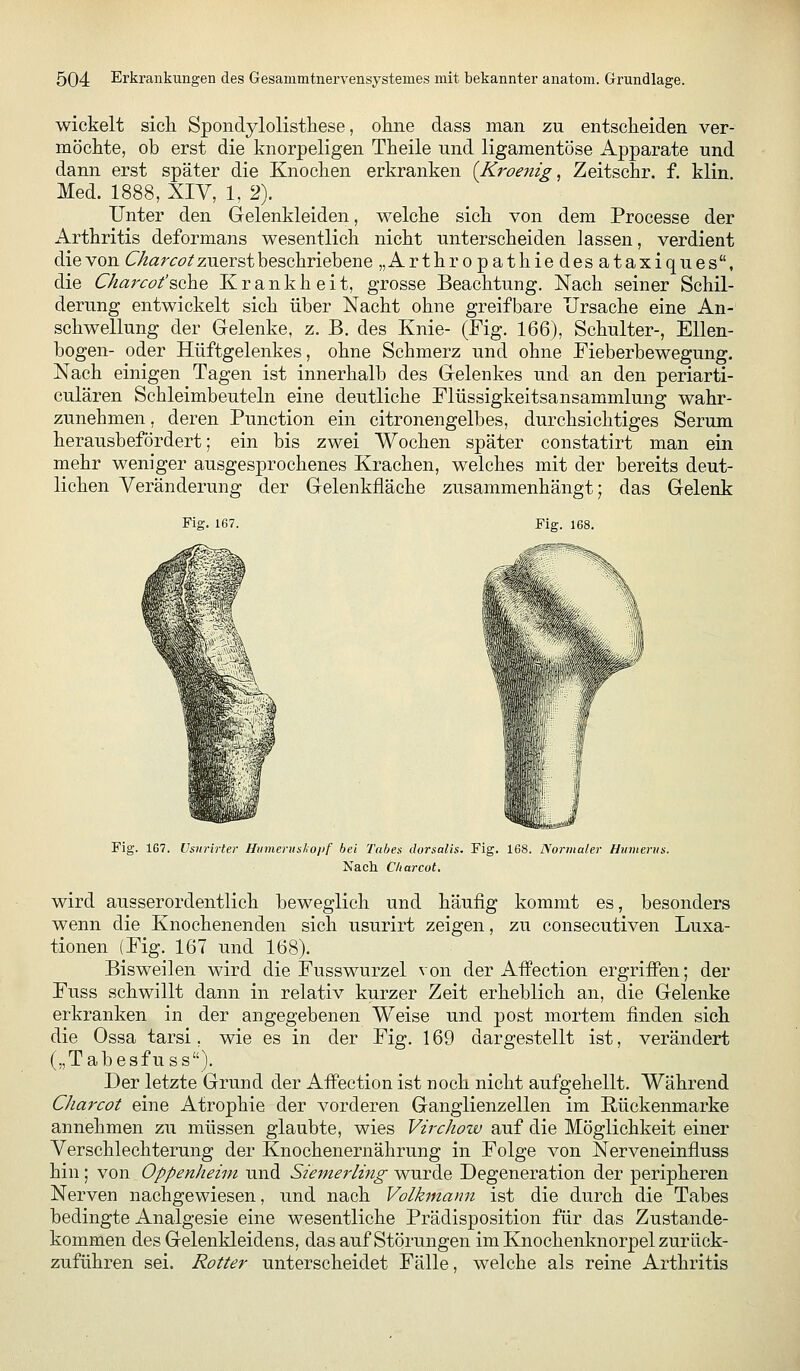 wickelt sich Spondylolisthese, okiie dass man zu entsclieiden ver- möcMe, ob erst die knorpeligen Theile und ligamentöse Apparate und dann erst später die Knocken erkranken {Kroenig, Zeitschr. f. klin Med. 1888, XIV, 1, 2). Unter den Gelenkleiden, welcke sich von dem Processe der Arthritis deformans wesentlich nicht unterscheiden lassen, verdient die von Charcot zuerst beschriebene „Arthropathiedesataxiques, die Charcot'^che Krankheit, grosse Beachtung. Nach seiner Schil- derung entwickelt sich über Nacht ohne greifbare Ursache eine An- schwellung der Gelenke, z. B. des Knie- (Fig. 166), Schulter-, Ellen- bogen- oder Hüftgelenkes, ohne Schmerz und ohne Fieberbewegung, Nach einigen Tagen ist innerhalb des Gelenkes und an den periarti- culären Schleimbeuteln eine deutliche Flüssigkeitsansammlung wahr- zunehmen , deren Function ein citronengelbes, durchsichtiges Serum herausbefördert; ein bis zwei Wochen später constatirt man ein mehr weniger ausgesprochenes Krachen, welches mit der bereits deut- lichen Veränderung der Gelenkfläche zusammenhängt; das Gelenk Fig. 168. Fig. 167. Vsiirirter Htimenisliopf hei Tabes dorsalis, Fig. 168. Diornialer Hinnenis. Nach Charcot. wird ausserordentlich beweglich und häufig kommt es, besonders wenn die Knochenenden sich usurirt zeigen, zu consecutiven Luxa- tionen (Fig. 167 und 168). Bisweilen wird die Fusswurzel von der Affection ergriffen; der Fuss schwillt dann in relativ kurzer Zeit erheblich an, die Gelenke erkranken in der angegebenen Weise und post mortem finden sieh die Ossa tarsi, wie es in der Fig. 169 dargestellt ist, verändert („Tabesfuss). Der letzte Grund der Affection ist noch nicht aufgehellt. Während Charcot eine Atrophie der vorderen Ganglienzellen im Rückenmarke annehmen zu müssen glaubte, wies VircJiotv auf die Möglichkeit einer Verschlechterung der Knochenernährung in Folge von Nerveneinfiuss hin; von Oppenheim und Siemerling wurde Degeneration der peripheren Nerven nachgewiesen, und nach Volkmann ist die durch die Tabes bedingte Analgesie eine wesentliche Prädisposition für das Zustande- kommen des Gelenkleidens, das auf Störungen im Knochenknorpel zurück- zuführen sei. Rotter unterscheidet Fälle, welche als reine Arthritis