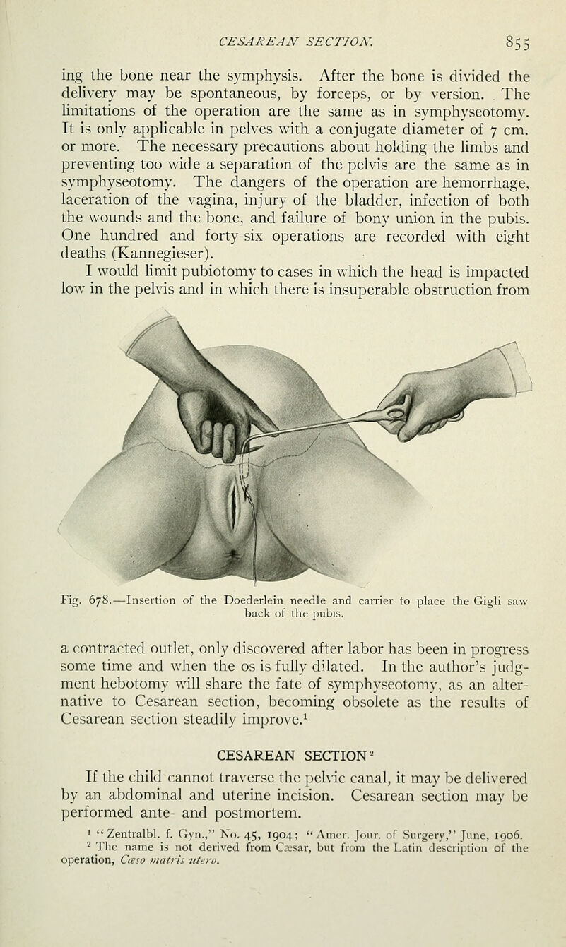 '3D ing the bone near the symphysis. After the bone is divided the delivery may be spontaneous, by forceps, or by version. The limitations of the operation are the same as in symphyseotomy. It is only applicable in pelves with a conjugate diameter of 7 cm. or more. The necessary precautions about holding the Hmbs and preventing too wide a separation of the pelvis are the same as in symphyseotomy. The dangers of the operation are hemorrhage, laceration of the vagina, injury of the bladder, infection of both the wounds and the bone, and failure of bony union in the pubis. One hundred and forty-six operations are recorded with eight deaths (Kannegieser). I would limit pubiotomy to cases in which the head is impacted low in the pelvis and in which there is insuperable obstruction from Fig. 678.—Insertion of the Doederlein needle and carrier to place the Gigli saw back of the pubis. a contracted outlet, only discovered after labor has been in progress some time and when the os is fully dilated. In the author's judg- ment hebotomy will share the fate of symphyseotomy, as an alter- native to Cesarean section, becoming obsolete as the results of Cesarean section steadily improve.^ CESAREAN SECTION'^ If the child cannot traverse the pehic canal, it may be delivered by an abdominal and uterine incision. Cesarean section may be performed ante- and postmortem. 1 Zentralbl. f. Gyn., No. 45, 1904;  Amer. Jour, of Surgery, Tmie, 1906. ^ The name is not derived from Ciusar, but from tlie Latin description of the operation, Caso viatris titei'o.