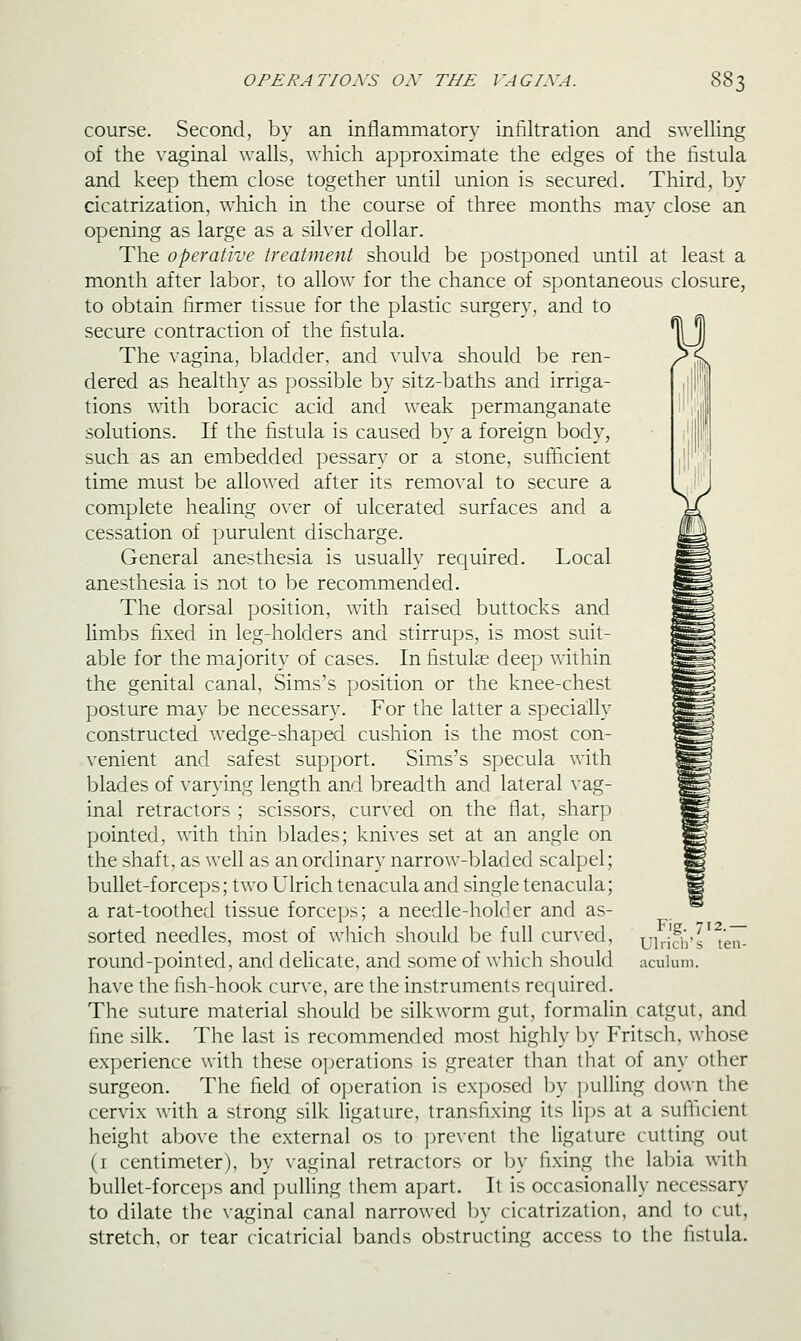 course. Second, by an inflammatory infiltration and swelling of the vaginal walls, which approximate the edges of the fistula and keep them close together until union is secured. Third, by cicatrization, which in the course of three months may close an opening as large as a silver dollar. The operative treatment should be postponed until at least a month after labor, to allow for the chance of spontaneous closure, to obtain firmer tissue for the plastic surgery, and to secure contraction of the fistula. \ j) The vagina, bladder, and ^•ulva should be ren- dered as healthy as possible by sitz-baths and irriga- tions with boracic acid and weak permanganate solutions. If the fistula is caused by a foreign body, such as an embedded pessary or a stone, sufficient time must be allowed after its removal to secure a complete healing over of ulcerated surfaces and a cessation of purulent discharge. General anesthesia is usually required. Local anesthesia is not to be recommended. The dorsal position, with raised buttocks and limbs fixed in leg-holders and stirrups, is most suit- able for the majority of cases. In fistulae deep within the genital canal, Sims's position or the knee-chest posture may be necessary. For the latter a specially constructed wedge-shaped cushion is the most con- venient and safest support. Sims's specula with blades of varying length and breadth and lateral vag- inal retractors ; scissors, curved on the flat, sharp pointed, with thin blades; knives set at an angle on the shaft, as well as an ordinary narrow-bladed scalpel; bullet-forceps; two Ulrich tenacula and single tenacula; a rat-toothed tissue forceps; a needle-holder and as- sorted needles, most of which should be full curved, round-pointed, and delicate, and some of which should have the fish-hook curve, are the instruments required. The suture material should be silkworm gut, formalin catgut, and fine silk. The last is recommended most highly by Fritsch, whose experience with these ojjerations is greater than that of any other surgeon. The field of operation is exposed by pulling down the cervix with a strong silk ligature, transfixing its lips at a sufficient height above the external os to j)revent the ligature cutting out (i centimeter), by \aginal retractors or by fixing the lal)ia with bullet-forceps and pulling them apart. It is occasionally necessary to dilate the vaginal canal narrowed by cicatrization, and to cut, stretch, or tear cicatricial bands obstructing access to the fistula. Fig. 712.— Ulrich s ten- aculum.