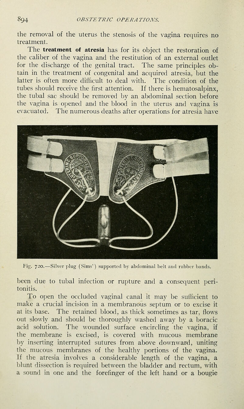 the removal of the uterus the stenosis of the vagina requires no treatment. The treatment of atresia has for its object the restoration of the caliber of the vagina and the restitution of an external outlet for the discharge of the genital tract. The same principles ob- tain in the treatment of congenital and acquired atresia, but the latter is often more difficult to deal with. The condition of the tubes should receive the first attention. If there is hematosalpinx, the tubal sac should be removed by an abdominal section before the vagina is opened and the blood in the uterus and vagina is evacuated. The numerous deaths after operations for atresia have Fig. 720.—Silver plug (Sims') supported by abdominal belt and rubber bands. been due to tubal infection or rupture and a consequent peri- tonitis. To open the occluded vaginal canal it may be sufticient to make a crucial incision in a membranous septum or to excise it at its base. The retained blood, as thick sometimes as tar, flows out slowly and should be thoroughly washed away by a boracic acid solution. The wounded surface encircling the vagina, if the membrane is excised, is covered with mucous membrane by inserting interrupted sutures from above downward, uniting the mucous membranes of the healthy portions of the vagina. If the atresia involves a considerable length of the vagina, a blunt dissection is required between the bladder and rectum, with a sound in one and the forefinger of the left hand or a bougie