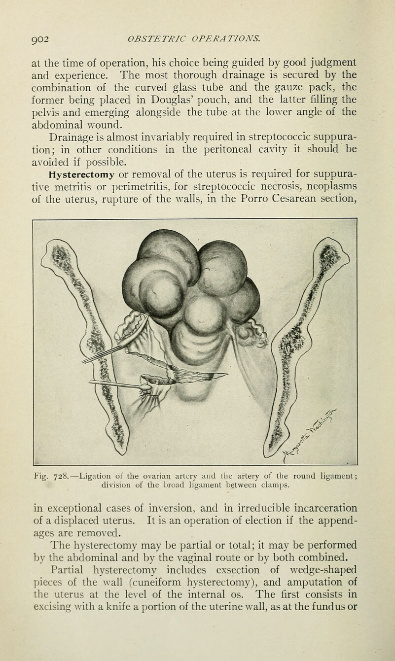 at the time of operation, his choice being guided by good judgment and experience. The most thorough drainage is secured by the combination of the curved glass tube and the gauze pack, the former being placed in Douglas' pouch, and the latter filling the pelvis and emerging alongside the tube at the lower angle of the abdominal wound. Drainage is almost invariably required in streptococcic suppura- tion; in other conditions in the peritoneal cavity it should be avoided if possible. Hysterectomy or removal of the uterus is required for suppura- tive metritis or perimetritis, for streptococcic necrosis, neoplasms of the uterus, rupture of the walls, in the Porro Cesarean section, Fig. 728.—Ligation of the ovarian artery and tlie artery of the round ligament: division of the broad ligament between clamps. in exceptional cases of inversion, and in irreducible incarceration of a displaced uterus. It is an operation of election if the append- ages are remo\'ed. The hysterectomy may be partial or total; it may be performed by the abdominal and by the vaginal route or by both combined. Partial hysterectomy includes exsection of wedge-shaped pieces of the wall (cuneiform hysterectomy), and amputation of the uterus at the level of the internal os. The first consists in excising with a knife a portion of the uterine wall, as at the fundus or