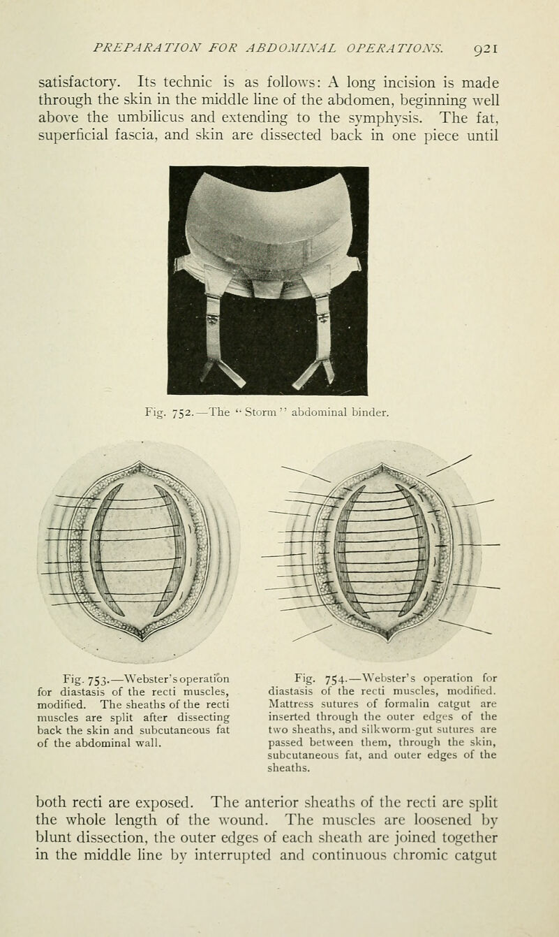 satisfactory. Its technic is as follows: A long incision is made through the skin in the middle line of the abdomen, beginning well above the umbilicus and extending to the symphysis. The fat, superficial fascia, and skin are dissected back in one piece until Fig. 752.—The '•Storm' abdominal binder. Fig. 753.—Webster's operation for diastasis of the recti muscles, modified. The sheaths of the recti muscles are split after dissecting back the skin and subcutaneous fat of the abdominal wall. Fig. 754.—Webster's operation for diastasis of the recti muscles, modified. Mattress sutures of formalin catgut are inserted through the outer edges of the two sheaths, and silkworm-gut sutures are passed between them, through the skin, subcutaneous fat, and outer edges of the sheaths. both recti are exposed. The anterior sheaths of the recti are split the whole length of the wound. The muscles are loosened by blunt dissection, the outer edges of each sheath are joined together in the middle Une by interrupted and continuous chromic catgut