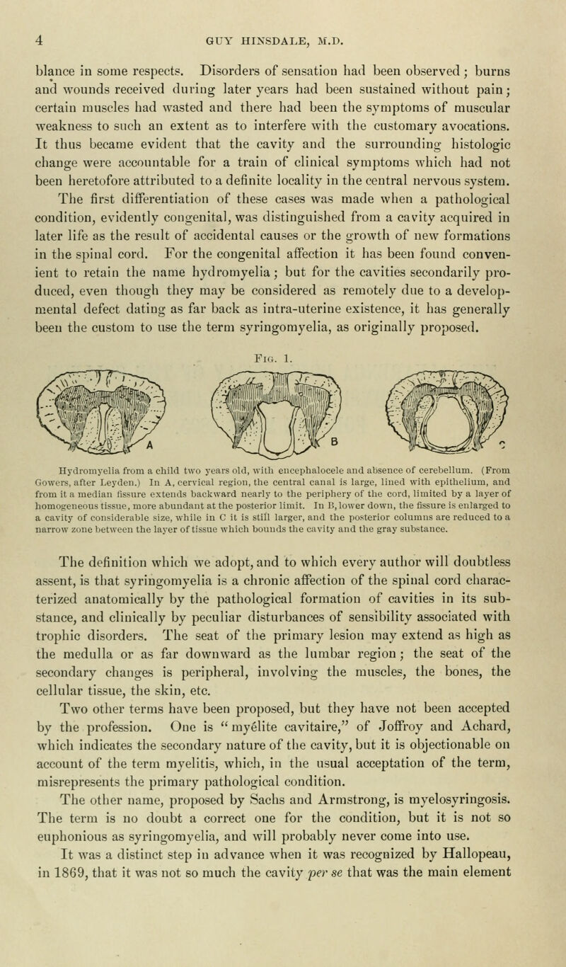 blance in some respects. Disorders of sensation had been observed ; burns and wounds received during later years had been sustained without pain; certain muscles had wasted and there had been the symptoms of muscular weakness to such an extent as to interfere with the customary avocations. It thus became evident that the cavity and the surrounding histologic change were accountable for a train of clinical symptoms which had not been heretofore attributed to a definite locality in the central nervous system. The first differentiation of these cases was made when a pathological condition, evidently congenital, was distinguished from a cavity acquired in later life as the result of accidental causes or the growth of new formations in the spinal cord. For the congenital affection it has been found conven- ient to retain the name hydromyelia; but for the cavities secondarily pro- duced, even though they may be considered as remotely due to a develop- mental defect dating as far back as intra-uterine existence, it has generally been the custom to use the term syringomyelia, as originally proposed. Fig. 1. Hydromyelia from a child two years old, with encephalocele and absence of cerebellum. (From Gowers, after Leyden.) In A, cervical region, the central canal is large, lined with epithelium, and from it a median Assure extends backward nearly to the periphery of the cord, limited by a layer of homogeneous tissue, more abundant at the posterior limit. In B, lower down, the fissure is enlarged to a cavity of considerable size, while in C it is still larger, and the posterior columns are reduced to a narrow zone between the layer of tissue which bounds the cavity and the gray substance. The definition which we adopt, and to which every author will doubtless assent, is that syringomyelia is a chronic affection of the spinal cord charac- terized anatomically by the pathological formation of cavities in its sub- stance, and clinically by peculiar disturbances of sensibility associated with trophic disorders. The seat of the primary lesion may extend as high as the medulla or as far downward as the lumbar region; the seat of the secondary changes is peripheral, involving the muscles, the bones, the cellular tissue, the skin, etc. Two other terms have been proposed, but they have not been accepted by the profession. One is  myelite cavitaire, of Joffroy and Achard, which indicates the secondary nature of the cavity, but it is objectionable on account of the term myelitis, which, in the usual acceptation of the term, misrepresents the primary pathological condition. The other name, proposed by Sachs and Armstrong, is myelosyringosis. The term is no doubt a correct one for the condition, but it is not so euphonious as syringomyelia, and will probably never come into use. It was a distinct step in advance when it was recognized by Hallopeau, in 1869, that it was not so much the cavity per se that was the main element