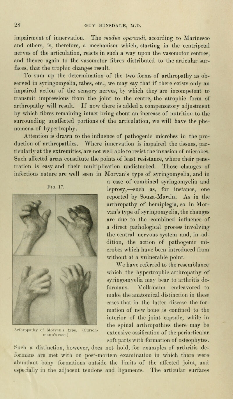 Fig. i; impairment of innervation. The modus operandi, according to Marinesco and others, is, therefore, a mechanism which, starting in the centripetal nerves of the articulation, reacts in such a way upon the vasomotor centres, and thence again to the vasomotor fibres distributed to the articular sur- faces, that the trophic changes result. To sum up the determination of the two forms of arthropathy as ob- served in syringomyelia, tabes, etc., we may say that if there exists only an impaired action of the sensory nerves, by which they are incompetent to transmit impressions from the joint to the centre, the atrophic form of arthropathy will result. If now there is added a compensatory adjustment by which fibres remaining intact bring about an increase of nutrition to the surrounding unaffected portions of the articulation, we will have the phe- nomena of hypertrophy. Attention is drawn to the influence of pathogenic microbes in the pro- duction of arthropathies. Where innervation is impaired the tissues, par- ticularly at the extremities, are not well able to resist the invasion of microbes. Such affected areas constitute the points of least resistance, where their pene- tration is easy and their multiplication undisturbed. Those changes of infectious nature are well seen in Morvan's type of syringomyelia, and in a case of combined syringomyelia and leprosy,—such as, for instance, one reported by Souza-Martin. As in the arthropathy of hemiplegia, so in Mor- van's type of syringomyelia, the changes are due to the combined influence of a direct pathological process involving the central nervous system and, in ad- dition, the action of pathogenic mi- crobes which have been introduced from without at a vulnerable point. We have referred to the resemblance which the hypertrophic arthropathy of syringomyelia may bear to arthritis de- formans. Volkmann endeavored to make the anatomical distinction in these cases that in the latter disease the for- mation of new bone is confined to the interior of the joint capsule, while in the spinal arthropathies there may be extensive ossification of the periarticular soft parts with formation of osteophytes. Such a distinction, however, does not hold, for examples of arthritis de- formans are met with on post-mortem examination in which there were abundant bony formations outside the limits of the affected joint, and especially in the adjacent tendons and ligaments. The articular surfaces Arthropathy of Morvan's type mann's case.) (Cursch-