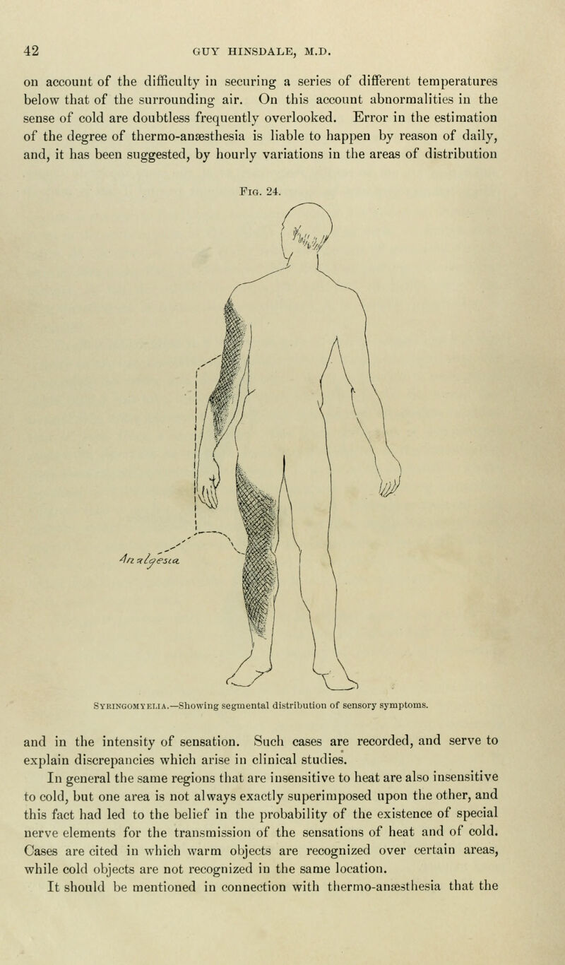 on account of the difficulty in securing a series of different temperatures below that of the surrounding air. On this account abnormalities in the sense of cold are doubtless frequently overlooked. Error in the estimation of the degree of thermo-anaesthesia is liable to happen by reason of daily, and, it has been suggested, by hourly variations in the areas of distribution Fig. 24. e$t Syringomyelia.—Showing segmental distribution of sensory symptoms. and in the intensity of sensation. Such cases are recorded, and serve to explain discrepancies which arise in clinical studies. In general the same regions that are insensitive to heat are also insensitive to cold, but one area is not always exactly superimposed upon the other, and this fact had led to the belief in the probability of the existence of special nerve elements for the transmission of the sensations of heat and of cold. Cases are cited in which warm objects are recognized over certain areas, while cold objects are not recognized in the same location. It should be mentioned in connection with thermo-ansesthesia that the