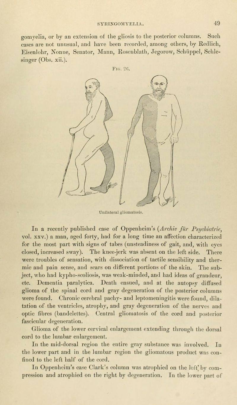 gomyelia, or by an extension of the gliosis to the posterior columns. Such cases are not unusual, and have been recorded, among others, by Redlich, Eisenlohr, Nonne, Senator, Mann, Rosenblath, Jegorow, Schiippel, Schle- singer (Obs. xii.). Fig. 26. Unilateral glioinatois. In a recently published case of Oppenheim's (Arehiv fur Psychiatrie, vol. xxv.) a man, aged forty, had for a long time an affection characterized for the most part with signs of tabes (unsteadiness of gait, and, with eyes closed, increased sway). The knee-jerk was absent on the left side. There were troubles of sensation, with dissociation of tactile sensibility and ther- mic and pain sense, and scars on different portions of the skin. The sub- ject, who had kypho-scoliosis, was weak-minded, and had ideas of grandeur, etc. Dementia paralytica. Death ensued, and at the autopsy diffused glioma of the spinal cord and gray degeneration of the posterior columns were found. Chronic cerebral pachy- and leptomeningitis were found, dila- tation of the ventricles, atrophy, and gray degeneration of the nerves and optic fibres (bandelettes). Central gliomatosis of the cord and posterior fascicular degeneration. Glioma of the lower cervical enlargement extending through the dorsal cord to the lumbar enlargement. In the mid-dorsal region the entire gray substance was involved. In the lower part and in the lumbar region the gliomatous product was con- fined to the left half of the cord. In Oppenheim's case Clark's column was atrophied on the lef'f by com- pression and atrophied on the right by degeneration. In the lower part of