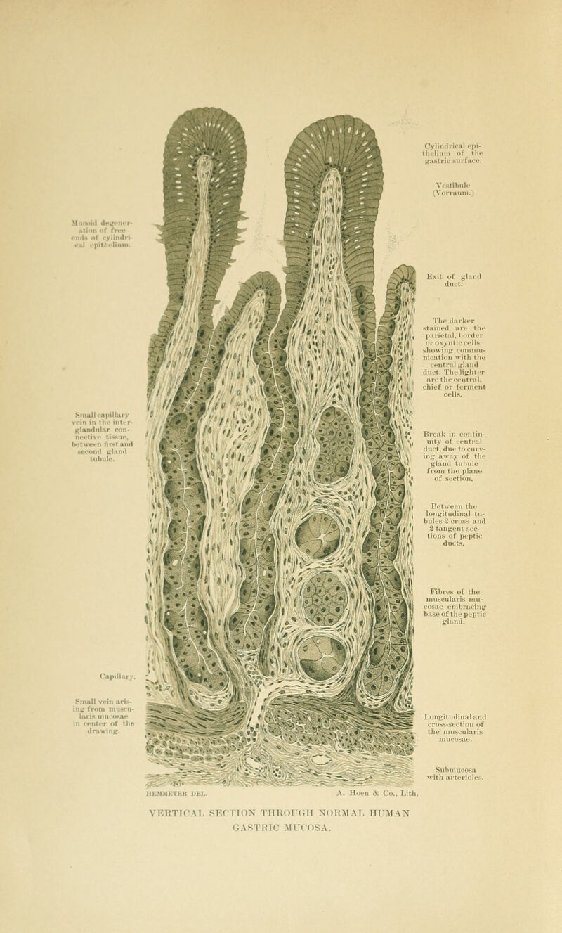 ation of fre« **mU of cylindn- oal rpitJxOiiiin. Small rHiMllaiy •ein in llif iiit.-r- K'landiilar con- nective tiiwuo, fii-Kt and seconil t;lnn<l tuhuie. bet Capillary. Small vein ari»- inK from musen- tariH mncoKai* in Pi'ntor of the drawinff. Cylindrical epi- thelinm of th« (rnstric surface Vestibule (.Vornmni.) VERTICAL .SECTION THROUGH NORMAL HUMAN GASTRIC MUCOSA.