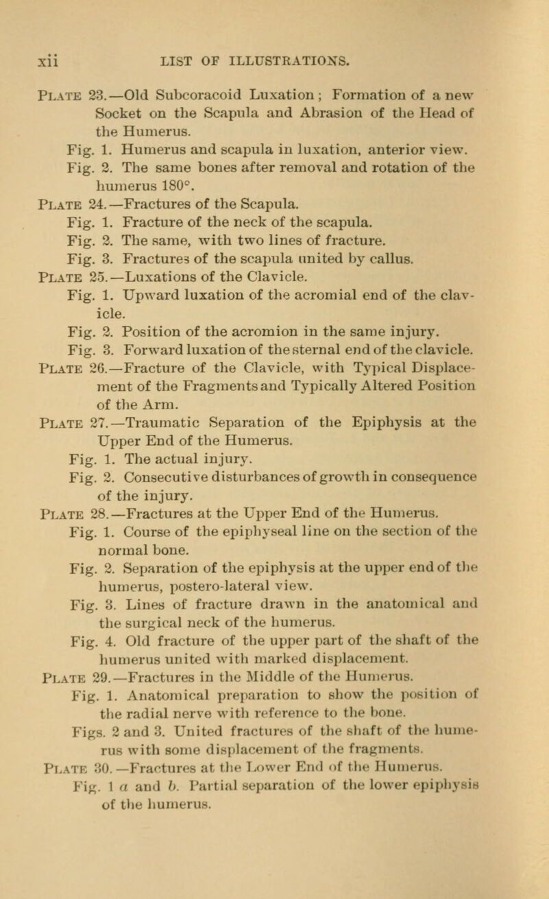 Plate 23.—Old Subcoracoid Luxation; Formation of anew Socket on the Scapula and Abrasion of the Head of the Humerus. Fig. 1. Humerus and scapula in luxation, anterior view. Fig. 2. The same bones after removal and rotation of the humerus 180^. Plate 24. —Fractures of the Scapula. Fig. 1. Fracture of the neck of the scapula. Fig. 2. The same, with two lines of fracture. Fig. 3. Fractures of the scapula united by callus. Plate 25.—Luxations of the Clavicle. Fig. 1. Upward luxation of the acromial end of the clav- icle. Fig. 2. Position of the acromion in the same injury. Fig. 3. Forward luxation of the sternal end of the clavicle. Plate 26.—Fracture of the Clavicle, with Typical Displace- ment of the Fragments and Typically Altered Position of the Arm. Plate 27.—Traumatic Separation of the Epiphysis at the Upper End of the Humerus. Fig. 1. The actual injury. Fig. 2. Consecutivedisturbancesof growth in consequence of the injury. Plate 28.—Fractures at the Upper End of the Humerus. Fig. 1. Course of the epiphyseal line on the section of the normal bone. Fig. 2. Separation of the epiphysis at the upper end of the humerus, posterolateral view. Fig. 3. Lines of fracture drawn in the anatomical and the surgical neck of the humerus. Fig. 4. Old fracture of the upper part of the shaft of the humerus united with marked displacement. Plate 29.—Fractures in the Middle of the Humerus. Fig. 1. Anatomical preparation to show the position of the radial nerve witli reference to the bone. Figs. 2 and 3. United fractures of the shaft of the hume- rus with some dis])lacement of the fragments. Plate 30.—Fractures at tlie Lower End of the Humerus. Fig. 1 a and h. Partial separation of the lower epiphysis of the humerus.