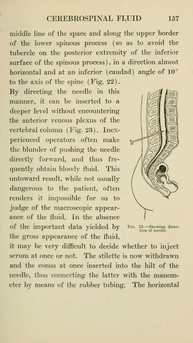 middle line of the space and along the upper border of the lower spinous process (so as to avoid the tubercle on the posterior extremity of the inferior surface of the spinous process), in a direction almost horizontal and at an inferior (caudad) angle of 10° to the axis of the spine (Fig. 22). By directing the needle in this manner, it can be inserted to a deeper level without encountering the anterior venous plexus of the vertebral column (Fig. 23). Inex- perienced operators often make the blunder of pushing the needle directly forward, and thus fre- quently obtain bloody fluid. This untoward result, while not usually dangerous to the patient, often renders it impossible for us to judge of the macroscopic appear- ance of the fluid. In the absence of the important data yielded by the gross appearance of the fluid, it may be very difficult to decide whether to inject serum at once or not. The stilette is now withdrawn and the conus at once inserted into the hilt of the needle, thus connecting the latter with the manom- eter by means of the rubber tubing. The horizontal Fig. 22.—Showing direc- tion of needle.