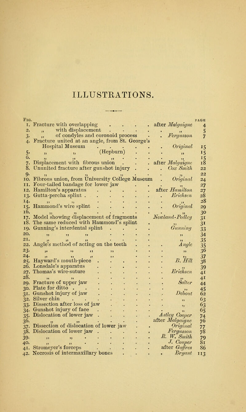 ILLUSTEATIONS. Fig. I. 2. 3- 4- 9- lo. II. 12. 13- 14. 15- 16. 17- 18. 19. 20. 21. 22. 23- 24. 25- 26. 27. 28. 29. 30. 31- 32. 33- 34- 35- 36. 37- 38. 39- 40. 41. 42. Fracture with overlapping .... after Malgaigue „ with displacement ,, of condyles and coronoid process . . Fergusson Fracture united at an angle, from St. George's Hospital Museum Original „ „ (Hepburn) Displacement with fibrous union . . . after llalgaigne Ununited fracture after gunshot injury . . . Cox Smith )1 >) 5) • • Fibrous union, from University College Museum Four-tailed bandage for lower jaw Hamilton's apparatus Gutta-percha splint . Hammond's wire splint Model showing displacement of fragments The same reduced with Hammond's splint Gunning's interdental splint Angle's method of acting on the teeth Hay ward's mouth-piece Lonsdale's apparatus Thomas's wire-suture Fracture of upper jaw Plate for ditto .... Gunshot injury of jaw Silver chin .... Dissection after loss of jaw Gunshot injury of face Dislocation of lower jaw . )) )) • • Dissection of dislocation of lower jaw Dislocation of lower jaw . Stromeyer's forceps Necrosis of intermaxillary bones Original after Hamilton Erichseii .. Original Newland-Pedley Gunning 5» )) Angle B. Hill Erichsen Salter DeboiU Astley Cooper after Malgaigne Original Fergusson R. W. Smith J. Cou2}er after Goffres . Bryant 4 5 7 15 15 IS 18 24 27 27 28 28 29 30 31 31 33 34 35 35 36 37 38 39 41 41 44 45 62 63 63 65 74 76 77 7^ 79 81 86 113