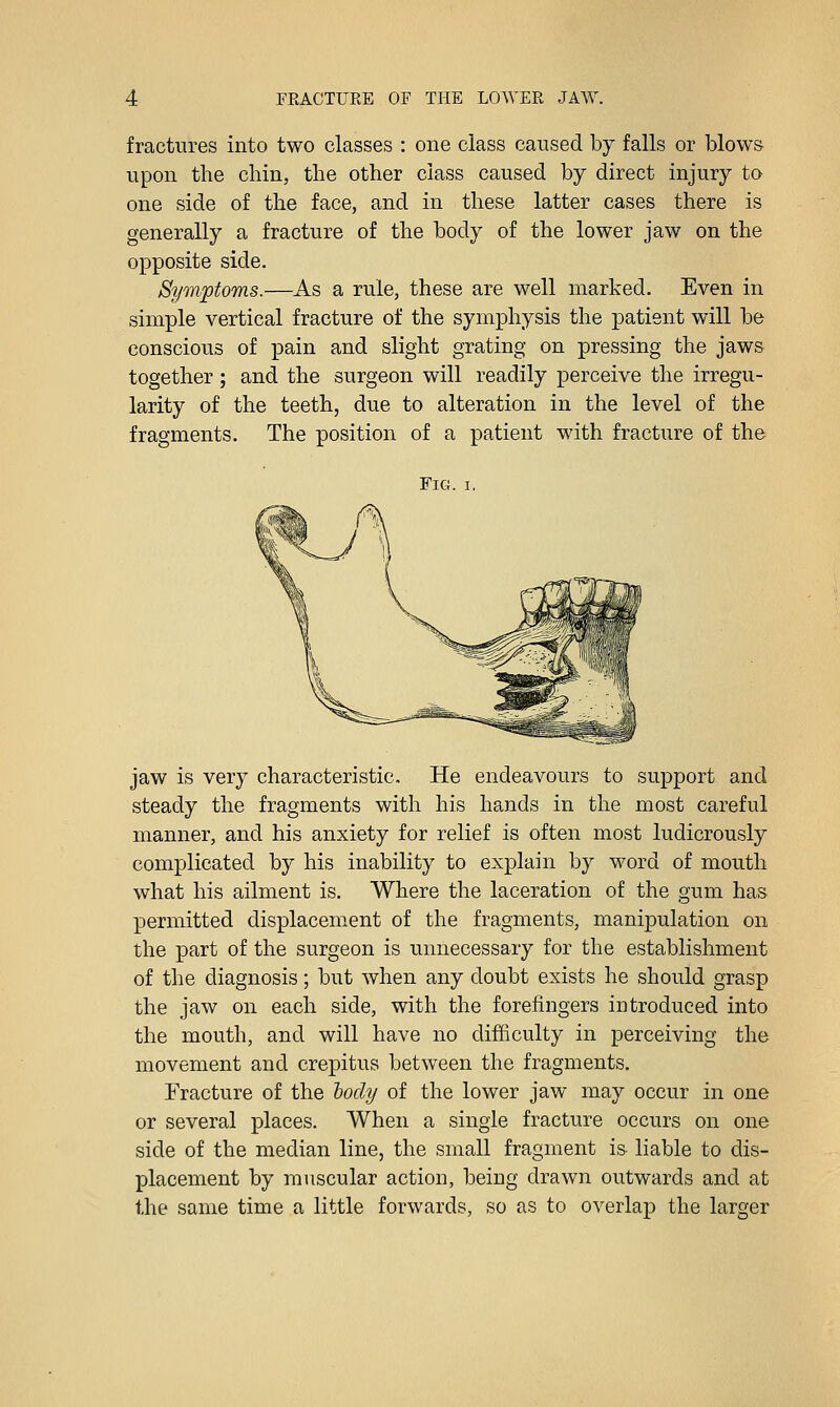 fractures into two classes : one class caused by falls or blows- upon the chin, the other class caused by direct injury to one side of the face, and in these latter cases there is generally a fracture of the body of the lower jaw on the opposite side. St/mptoms.—As a rule, these are well marked. Even in simple vertical fracture of the symphysis the patient will be conscious of pain and slight grating on pressing the jaws together; and the surgeon will readily perceive the irregu- larity of the teeth, due to alteration in the level of the fragments. The position of a patient with fracture of the Fig. I. jaw is very characteristic. He endeavours to support and steady the fragments with his hands in the most careful manner, and his anxiety for relief is often most ludicrously complicated by his inability to explain by word of mouth what his ailment is. Where the laceration of the gum has permitted displacement of the fragments, manipulation on the part of the surgeon is unnecessary for the establishment of the diagnosis; but when any doubt exists he should grasp the jaw on each side, with the forefingers iutroduced into the mouth, and will have no difficulty in perceiving the movement and crepitus between the fragments. Fracture of the hody of the lower jaw may occur in one or several places. When a single fracture occurs on one side of the median line, the small fragment is liable to dis- placement by muscular action, being drawn outwards and at the same time a little forwards, so as to overlap the larger