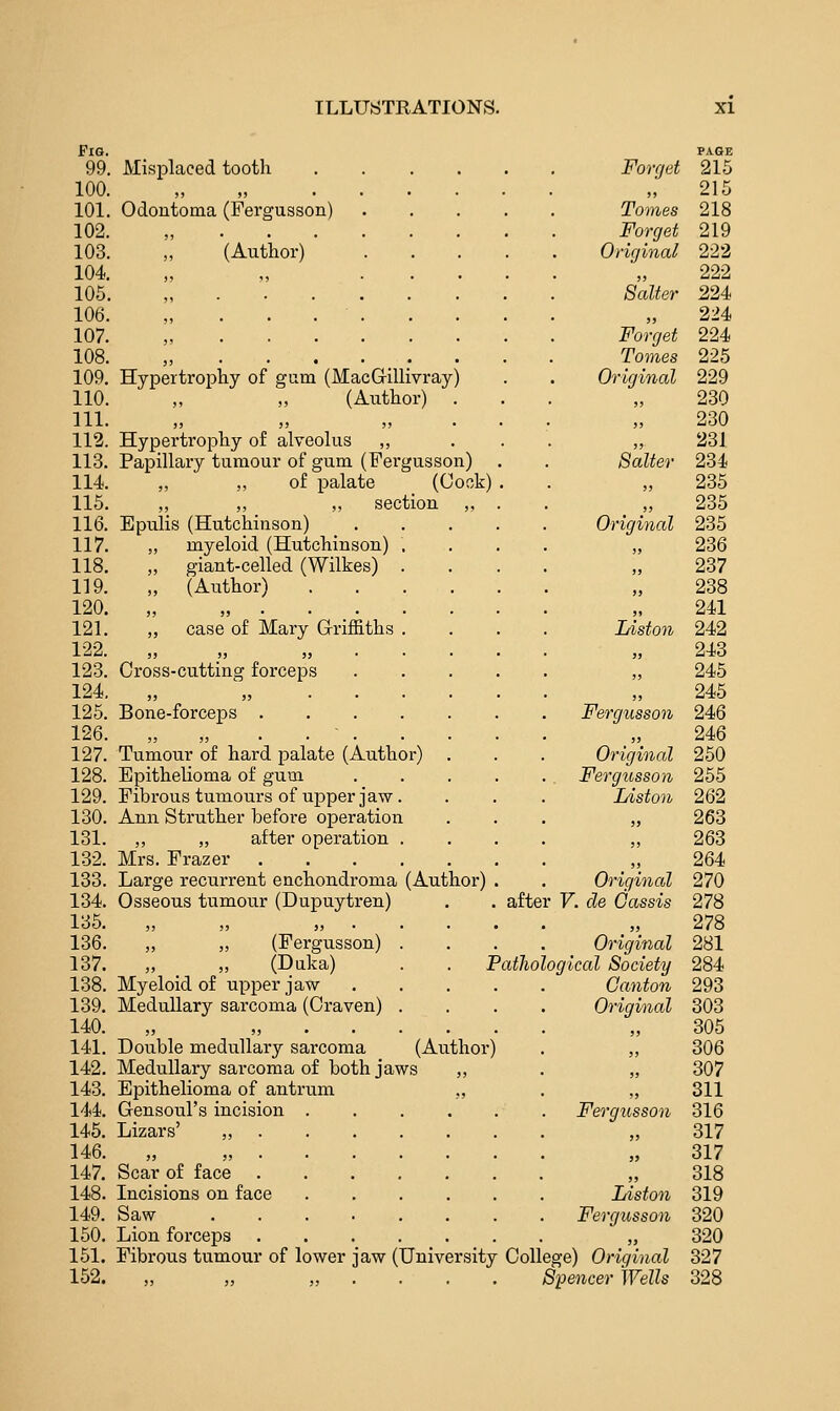 Fig. PAGE 99. Misplaced tooth .... Forget 215 100. „ „ .... )> 215 101. Odontoma (Fergusson) Tomes 218 102. „ Forget 219 103. „ (Author) Original 222 104 „ „ ... )) 222 105. „ Salter 224 106. „ . . . . 5) 224 107. „ Forget 224 108. „ Tomes 225 109. Hypertrophy of gum (MacGillivray) Original 229 110. „ „ (Author) . „ 230 111. •  ?j 230 112. Hypertrophy of alveolus ,, )j 231 113. Papillary tumour of gum (Fergusson) Salter 234 114. „ „ of palate _ (Cock) „ 235 115. „ „ „ section ,, )) 235 116. Epulis (Hutchinson) _ . Original 235 117. „ myeloid (Hutchinson) . j> 236 118. „ giant-celled (Wilkes) . „ 237 119. „ (AiTthor) .... >j 238 120. „ „ • )> 241 121. „ case of Mary (Griffiths . Listen 242 }> 243 123. Cross-cutting forceps ,, 245 124. „ „ . . . . )) 245 125. Bone-forceps Fergusson 246 126. „ „ ..... ' )) 246 127. Tumour of hard palate (Author) . Original 250 128. Epithelioma of gum . . Fergusson 255 129. Fibrous tumours of upper jaw. Liston 262 130. Ann Struther before operation !) 263 131. ,, „ after operation . ,, 263 132. Mrs. Frazer IJ 264 133. Large recurrent enchondroma (Author) . Original 270 134. Osseous tumour (Dupuytren) after F. de Cassis 278 135. „ „ „ . . . . • )? 278 136. „ „ (Fergusson) . Original 281 137. „ „ (Duka) . . I atliological Society 284 138. Myeloid of upper jaw . . . . Canton 293 139. Medullary sarcoma (Craven) . Original 303 140. „ „ »j 305 141. Double medullary sarcoma (Author) 5> 306 142. Medullary sarcoma of both jaws „ 307 143, Epithelioma of antrum „ » 311 144. Gensoul's incision . . . . . Fergusson 316 145. Lizars' ,, ' >> 317 146. „ „ • 99 317 147. Scar of face 318 148. Incisions on face Liston 319 149. Saw Fergusson 320 150. Lion forceps ...... 9) 320 151. Fibroiis tumour of lower jaw (University College) Original 327 152. „ „ ,,.... Spencer Wells 328