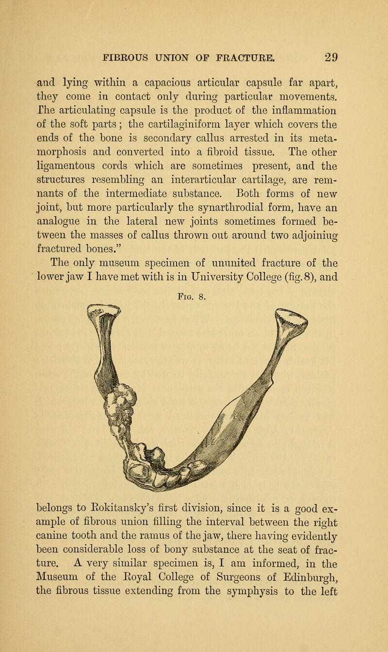 aud lying within a capacious articular capsule far apart, they come in contact only during particular movements. The articulating capsule is the product of the inflammation of the soft parts; the cartilaginiform layer which covers the ends of the bone is secondary callus arrested in its meta- morphosis and converted into a fibroid tissue. The other ligamentous cords which are sometimes present, aud the structures resembling an interarticular cartilage, are rem- nants of the intermediate substance. Both forms of new joint, but more particularly the synarthrodia! form, have an analogue in the lateral new joints sometimes formed be- tween the masses of callus thrown out around two adjoining fractured bones. The only museum specimen of ununited fracture of the lower jaw I have met with is in University College (fig. 8), and Fig. 8. belongs to Eokitansky's first division, since it is a good ex- ample of fibrous union filling the interval between the right canine tooth and the ramus of the jaw, there having evidently been considerable loss of bony substance at the seat of frac- ture. A very similar specimen is, I am informed, in the Museum of the Eoyal College of Surgeons of Edinburgh, the fibrous tissue extending from the symphysis to the left