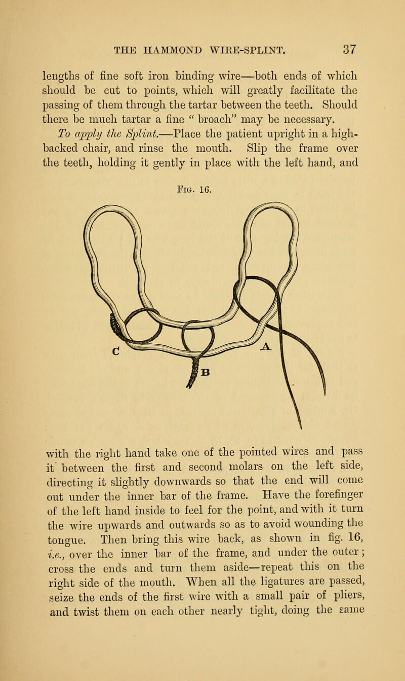 lengths of fine soft iron binding wire—both ends of which should be cut to points, which will greatly facilitate the passing of them through the tartar between the teeth. Should there be much tartar a fine  broach may be necessary. To aii'ply the Splint.—Place the patient upright in a high- backed chair, and rinse the mouth. Slip the frame over the teeth, holding it gently in place with the left hand, and Fig. 16. with the right hand take one of the pointed wires and pass it between the first and second molars on the left side, directing it slightly downwards so that the end will come out under the inner bar of the frame. Have the forefinger of the left hand inside to feel for the point, and with it turn the wire upwards and outwards so as to avoid wounding the tongue. Then bring this wire back, as shown in fig. 16, i.e., over the inner bar of the frame, and under the outer; cross the ends and turn them aside—repeat this on the right side of the mouth. When all the ligatures are passed, seize the ends of the first wire with a small pair of pliers, and twist them on each other nearly tight, doing the same