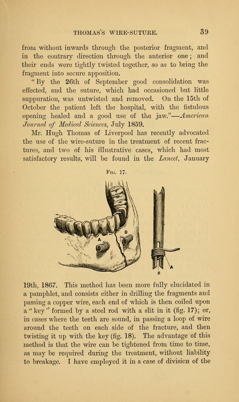 from without inwards through the posterior fragment, and in the contrary direction through the anterior one; and their ends were tightly twisted together, so as to bring the fragment into secure apposition.  By the 26th of September good consolidation was effected, and the suture, which had occasioned but little suppuration, was untwisted and removed. On the 15tli of October the patient left the hospital, with the fistulous opening healed and a good use of the jaw.—American Journal of Medical Sciences, July 1859. Mr. Hugh Thomas of Liverpool has recently advocated the use of the wire-suture in the treatment of recent frac- tures, and two of his illustrative cases, which had most satisfactory results, will be found hi the Lancet, January 19th, 1867. This method has been more fully elucidated in a pamphlet, and consists either in drilling the fragments and passing a copper wire, each end of which is then coiled upon a  key  formed by a steel rod with a slit in it (fig. 17); or, in cases where the teeth are sound, in passing a loop of wire around the teeth on each side of the fracture, and then twiwSting it up with the key (fig. 18). The advantage of this method is that the wire can be tightened from time to time, as may be required during the treatment, without liability to breakage. I have employed it in a case of division of the