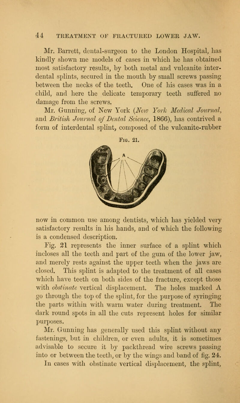 Mr. Barrett, dental-surgeon to the London Hospital, has kindly shown me models of cases in which he has obtained most satisfactory results, by both metal and vulcanite inter- dental splints, secured in the mouth by small screws passing between the necks of the teeth. One of his cases was in a child, and here the delicate temporary teeth suffered no damage from the screws. Mr. Gunning, of New York {Nciv York Medical Journal, and British Journal of Dental l:^ciencc, 1866), has contrived a form of interdental splint,, composed of the vulcanite-rubber Fig, 21. now in common use among dentists, which has yielded very satisfactory results in his hands, and of which the following is a condensed description. Y\g. 21 represents the inner surface of a splint which incloses all the teeth and part of the gum of the lower jaw, and merely rests against the upper teeth when the jaws are closed. This s})lint is adapted to the treatment of all cases which have teeth on both sides of the fracture, except those with ohstinatc vertical dis^jlacement. The holes marked A go through tliu top of the splint, for the purpose of syringing the parts within witli warm water during treatment. The dark round spots in all tlie cuts represent holes for similar purposes. Mr. Gunning lias generally used this splint without any fastenings, but in children, or even adults, it is sometimes advisable to secure it by packthread wire screws passing into or between the tectli, or by the wings and band of fig. 24. In cases with obstinate vertical displacement, the sjjlint^