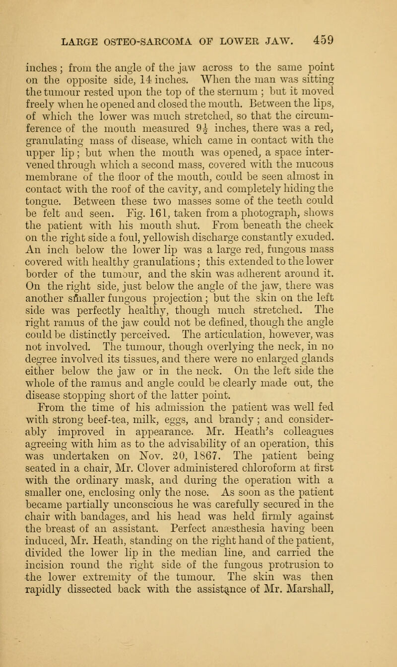 inches ; from the angle of the jaw across to the same point on tlie opposite side, 14 inches. When the man was sitting the tumour rested upon the top of the sternum ; but it moved freely when he opened and closed the mouth. Between the lips, of which the lower was much stretched, so that the circum- ference of the mouth measured 9^ inches, there was a red, granulating mass of disease, which came in contact with the upper lip; but wdien the mouth was opened^ a space inter- vened through which a second mass, covered with the mucous membrane of the floor of the mouth, could be seen almost in contact with the roof of the cavity, and completely hiding the tongue. Between these two masses some of the teeth could be felt and seen. Fig. 161, taken from a photograph, shows the patient wdtli liis mouth shut. From beneath the cheek on the right side a foul, yellowish discharge constantly exuded. An inch below the lower lip was a large red, fimgous mass covered with healthy granulations; this extended to the lower border of the tumour, and the skin was adherent around it. On the right side, just below the angle of the jaw, there was another sflialler fungous projection; but the skin on the left side w^as perfectly healthy, though much stretched. The right ramus of the jaw could not be defined, though the angle could be distinctly perceived. The articulation, however, was not involved. The tumour, though overlying the neck, in no degree involved its tissues, and there were no enlarged glands either below the jaw or in the neck. On the left side the whole of the ramus and angle could be clearly made out, the disease stopping short of the latter point. From the time of his admission the patient was well fed with strong beef-tea, milk, eggs, and brandy; and consider- ably improved in appearance. Mr. Heath^s colleagues agreeing with him as to the advisability of an operation, tliis was undertaken on Nov. 20, 1S67. The patient being seated in a chair, Mr. Clover administered chloroform at first with the ordinary mask, and during the operation with a smaller one, enclosing only the nose. As soon as the patient became partially unconscious he was carefully secured in the chair with bandages, and his head was held firmly against the breast of an assistant. Perfect anaesthesia having been induced, Mr. Heath, standing on the right hand of the patient, divided the lower lip in the median line, and carried the incision round the right side of the fungous protrusion to •the lower extremity of the tumour. The skin was then rapidly dissected back with the assistance of Mr. Marshall,
