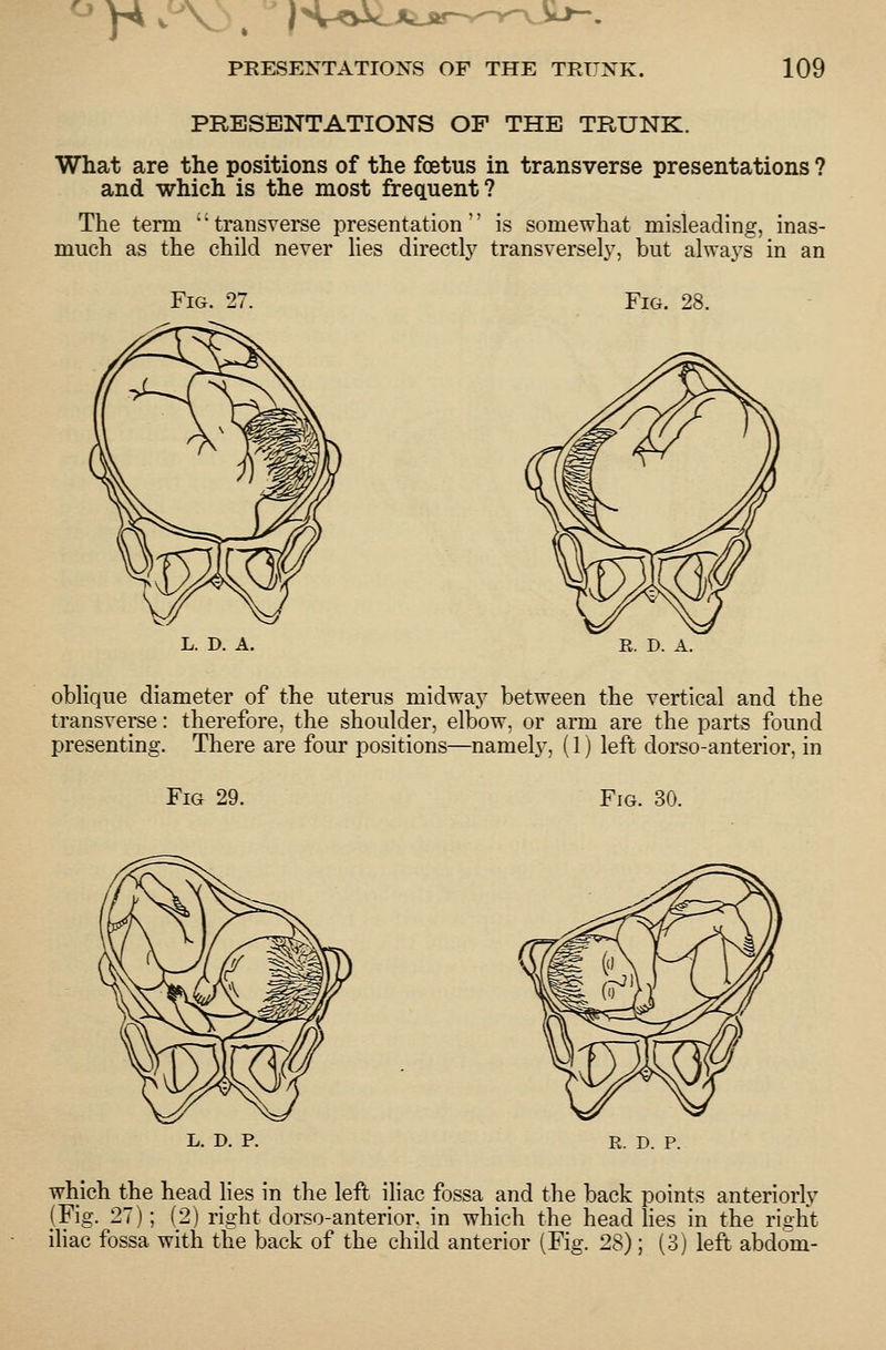 PRESENTATIONS OF THE TRUNK. What are the positions of the foetus in transverse presentations ? and which is the most frequent? The term ''transverse presentation is somewhat misleading, inas- much as the child never lies directly transversely, but always in an Fig. 27. Fig. 28. L. D. A. R. D. A. oblique diameter of the uterus midway between the vertical and the transverse: therefore, the shoulder, elbow, or arm are the parts found presenting. There are four positions—namely, (1) left dorso-anterior, in Fig 29. Fig. 30. R. D. P. which the head lies in the left iliac fossa and the back points anteriorly (Fig. 27); (2) right dorso-anterior. in which the head lies in the right iliac fossa with the back of the child anterior (Fig. 28); (3) left abdom-