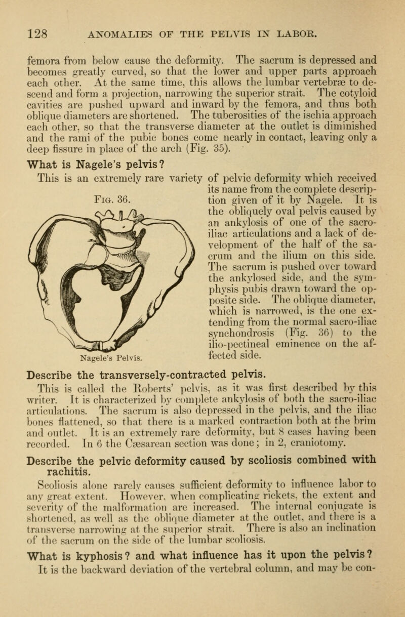 femora from below cause the deformitj'. The sacrum is depressed and becomes greatly curved, so that the lower and upper pai-ts approach each other. At the same time, this allows the lumbar vertebrae to de- scend and form a projection, narrowing the superior strait. The cotyloid cavities are pushed upward and inward by the femora, and thus both oblique diameters are shortened. The tuberosities of the ischia approach each other, so that the transverse diameter at the outlet is diminished and the rami of the pubic bones come nearly in contact, leaving only a deep fissure in place of the arch (Fig. 35). What is Nagele's pelvis? This is an extremely rare variety of pelvic deformity which received its name from the complete descrip- FiG. 36. tion given of it by N^agele. It is the obliquely oval pelvis caused by an ankylosis of one of the sacro- iliac articulations and a lack of de- velopment of the half of the sa- crum and the ilium on this side. The sacrum is pushed over toward the ankylosed side, and the sym- physis pubis drawn toward the op- posite side. The oblique diameter, which is narrowed, is the one ex- tending from the normal sacro-iliac synchondrosis (Fig. 36) to the ilio-pectineal eminence on the af- Na^et^Tpeivis. fccted side. Describe the transversely-contracted pelvis. This is called the Roberts' pelvis, as it was first described by this writer. It is characterized by comi)lete ankylosis of both the sacro-iliac articulations. The sacrum is also depressed in the pelvis, and the iliac bones flattened, so that there is a marked contraction both at the brim and outlet. It is an extremely rare deformity, but H cases having been recorded. In 6 the Caesarean section was done; in 2, craniotomy. Describe the pelvic deformity caused by scoliosis combined with rachitis. Scoliosis alone rarely causes sufficient deformity to influence labor to any great extent. Hf)Wover, when complicatiuiz rickets, the extent and severity of the malformation are increased. The internal conjugate is shortened, as well as the oblique diameter at the outlet, and there is a transverse narrowing at the superior strait. There is also an inclination of the sacrum on the side of the lumbar scoliosis. What is kyphosis? and what influence has it upon the pelvis? It is the backward deviation of the vertebral column, and may be con-