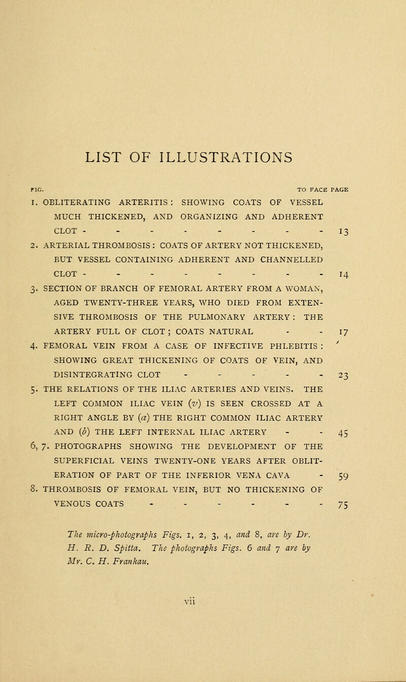 LIST OF ILLUSTRATIONS FIG. TO FACE PAGE 1. OBLITERATING ARTERITIS : SHOWING COATS OF VESSEL MUCH THICKENED, AND ORGANIZING AND ADHERENT CLOT - - - - - - - - 13 2. ARTERIAL THROMBOSIS : COATS OF ARTERY NOT THICKENED, BUT VESSEL CONTAINING ADHERENT AND CHANNELLED CLOT -------- 14 3. SECTION OF BRANCH OF FEMORAL ARTERY FROM A WOMAN, AGED TWENTY-THREE YEARS, WHO DIED FROM EXTEN- SIVE THROMBOSIS OF THE PULMONARY ARTERY: THE ARTERY FULL OF CLOT; COATS NATURAL - - I? 4. FEMORAL VEIN FROM A CASE OF INFECTIVE PHLEBITIS : ' SHOWING GREAT THICKENING OF COATS OF VEIN, AND DISINTEGRATING CLOT - - - - - 23 5. THE RELATIONS OF THE ILIAC ARTERIES AND VEINS. THE LEFT COMMON ILIAC VEIN (■Z/) IS SEEN CROSSED AT A RIGHT ANGLE BY (a) THE RIGHT COMMON ILIAC ARTERY AND (p) THE LEFT INTERNAL ILIAC ARTERY - 45 6. 7. PHOTOGRAPHS SHOWING THE DEVELOPMENT OF THE SUPERFICIAL VEINS TWENTY-ONE YEARS AFTER OBLIT- ERATION OF PART OF THE INFERIOR VENA CAVA - 59 8. THROMBOSIS OF FEMORAL VEIN, BUT NO THICKENING OF VENOUS COATS - . - - - - 75 The micro-photographs Figs, i, 2, 3, 4, and 8, are by Dr. H. R. D, Spitta. The photographs Figs. 6 and 7 are by Mr. C. H. Frankau.