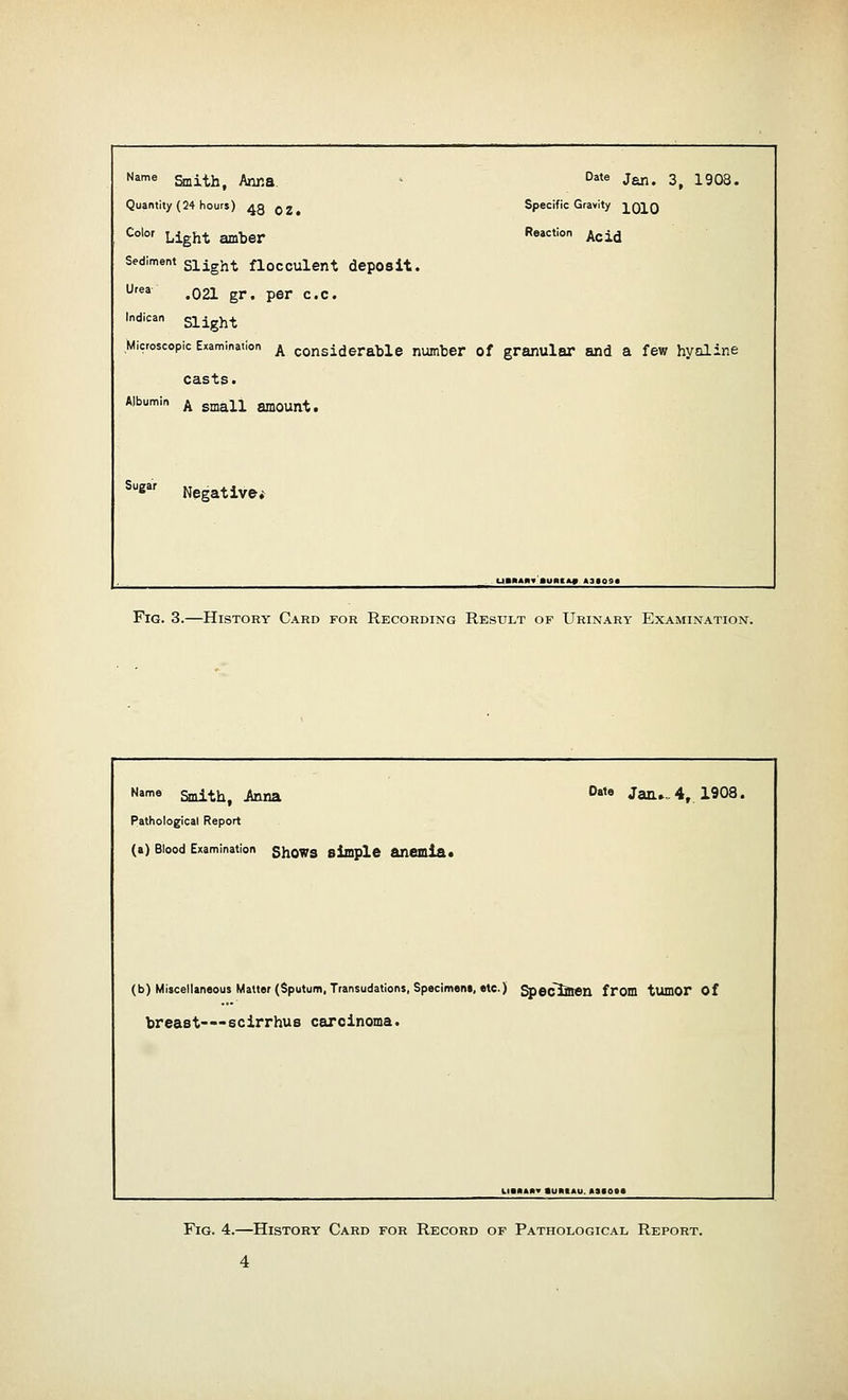 Name Smith, Anna. , Date Jan. 3, 1908. Quantity (24 hours) 43 oz. Specific C ravity 1010 Color Light amber Reaction Acid Sediment Slight floCCUlent deposit. Urea .021 gr. per c.c. Indican Slight Microscopic Examination A considerable number of granular and a few hyaline casts. Albumin A small amount. Suear Negative* UBRAMv'auRtA* »saos Fig. 3.—History Card for Recording Result of Urinary Examination. Name Smith, Anna Date Jan.. 4, 1908. Pathological Report (a) Blood Examination ShOWS simple anemia* (b) Miscellaneous Matter (Sputum Transudations, Specimens, etc.) Specimen from tumor of breast-—scirrhus carcinoma. Fig. 4.—History Card for Record of Pathological Report.