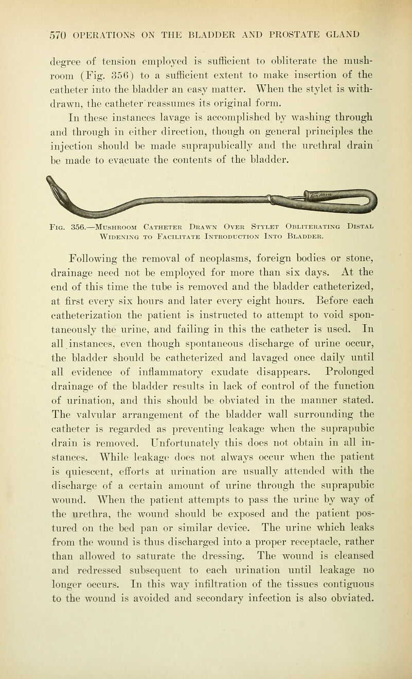 degree of tension employed is sufficient to obliterate the mush- room (Fig. 356) to a sufficient extent to make insertion of the catheter into the bladder an easy matter. When the stylet is with- drawn, the catheter'reassumes its original form. In these instances lavage is accomplished by washing through and through in either direction, though on general principles the injection should be made suprapubically and the urethral drain be made to evacuate the contents of the bladder. Fig. 356.—Mushroom Catheter Drawn Over Stylet Obliterating Distal Widening to Facilitate Introduction Into Bladder. Following the removal of neoplasms, foreign bodies or stone, drainage need not be employed for more than six days. At the end of this time the tube is removed and the bladder catheterized, at first every six hours and later every eight hours. Before each catheterization the patient is instructed to attempt to void spon- taneously the urine, and failing in this the catheter is used. In all instances, even though spontaneous discharge of urine occur, the bladder should be catheterized and lavaged once daily until all evidence of inflammatory exudate disappears. Prolonged drainage of the bladder results in lack of control of the function of urination, and this should be obviated in the manner stated. The valvular arrangement of the bladder wall surrounding the catheter is regarded as preventing leakage when the suprapubic drain is removed. Unfortunately this does not obtain in all in- stances. While leakage does not always occur when the patient is quiescent, efforts at urination are usually attended with the discharge of a certain amount of urine through the suprapubic wound. When the patient attempts to pass the urine by way of the urethra, the wound should be exposed and the patient pos- tured on the bed pan or similar device. The urine which leaks from the wound is thus discharged into a proper receptacle, rather than allowed to saturate the dressing. The wound is cleansed and redressed subsequent to each urination until leakage no longer occurs. In this way infiltration of the tissues contiguous to the wound is avoided and secondary infection is also obviated.